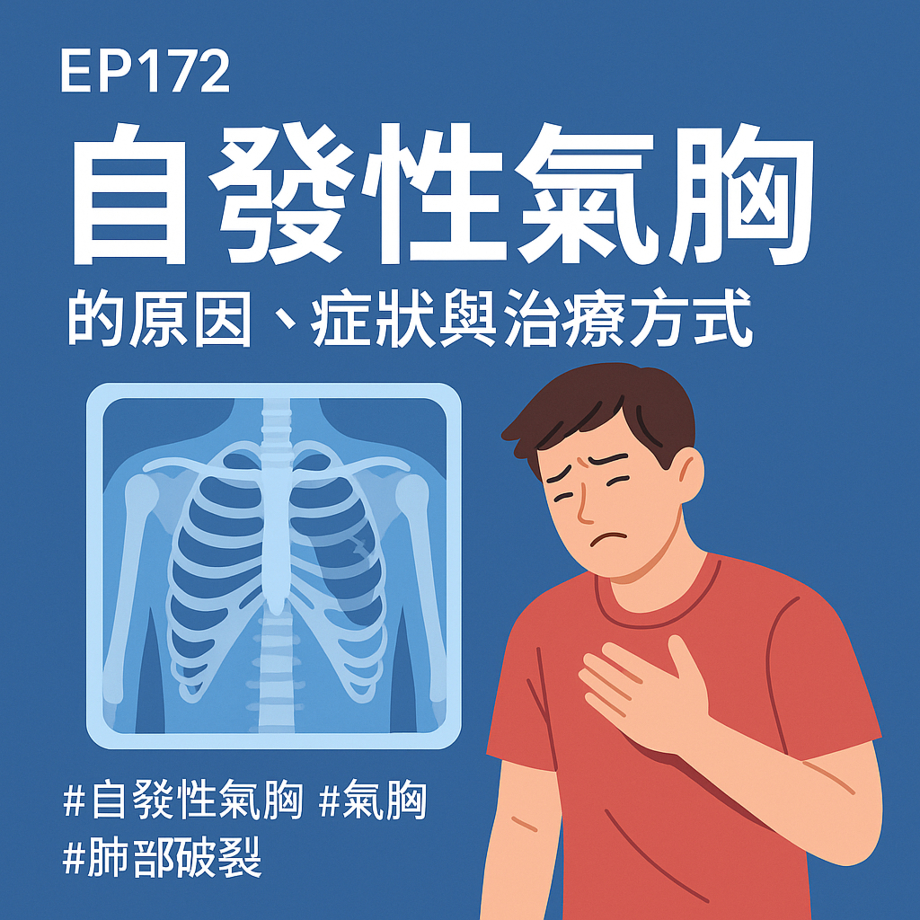 🎙️EP172｜年輕人也可能「肺破掉」？自發性氣胸的原因、症狀與治療方式