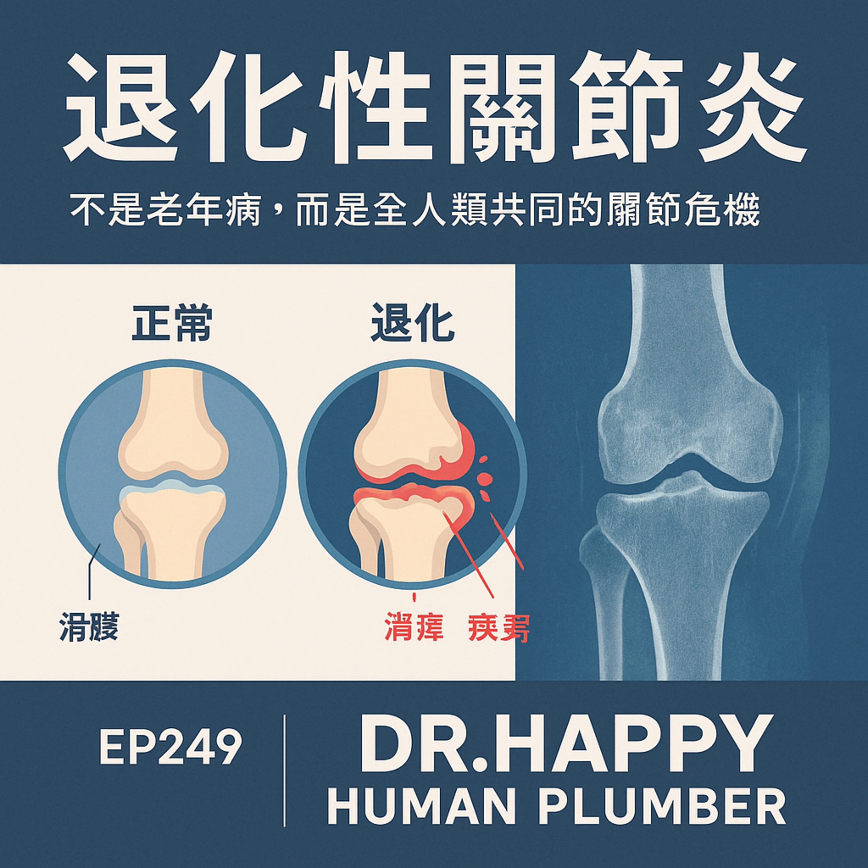 🎙️EP249｜退化性關節炎：不是老年病，而是全人類共同的關節危機