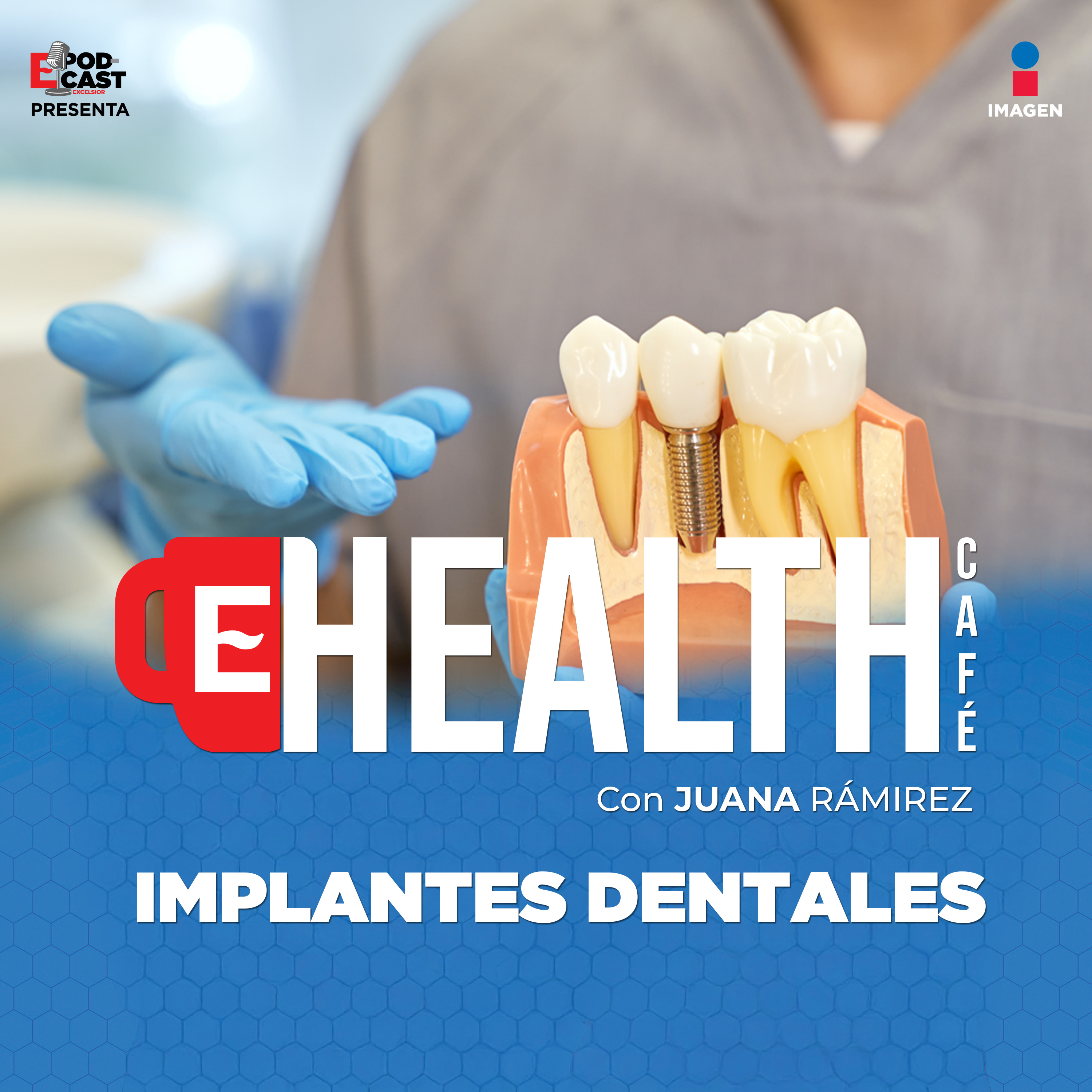 Una sonrisa contagia y crea un ambiente más positivo|T.1 - EP. 11 | Implantes Dentales| Health Café episode artwork