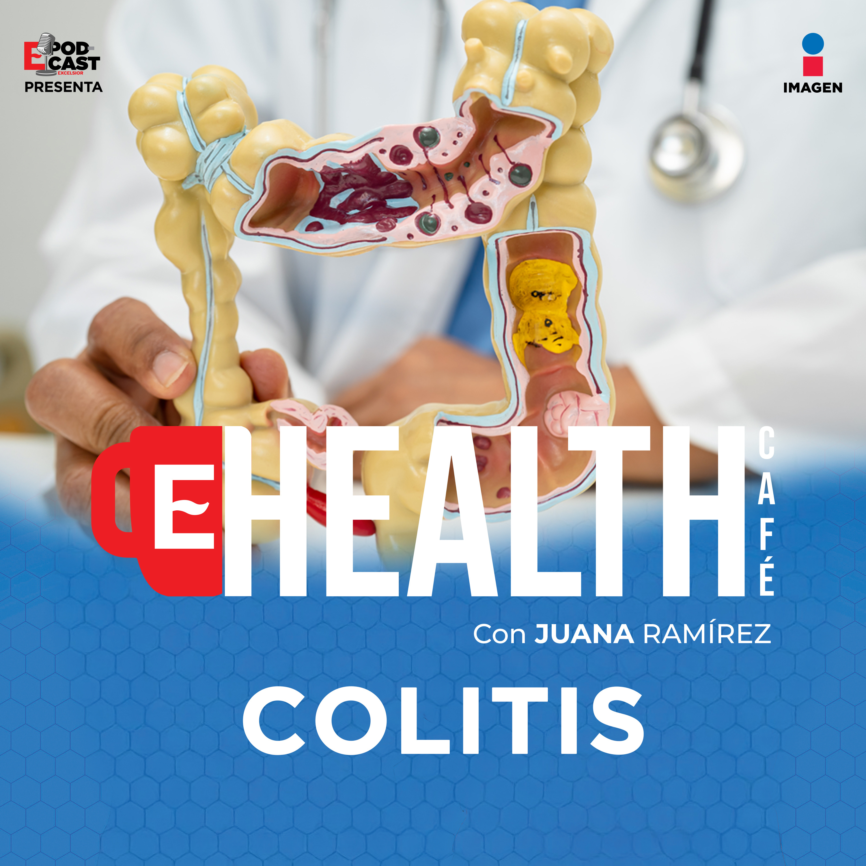 ¿enfermedad del intestino o reflejo de tus emociones? |T.1 - EP. 13|Colitis| Health Café episode artwork