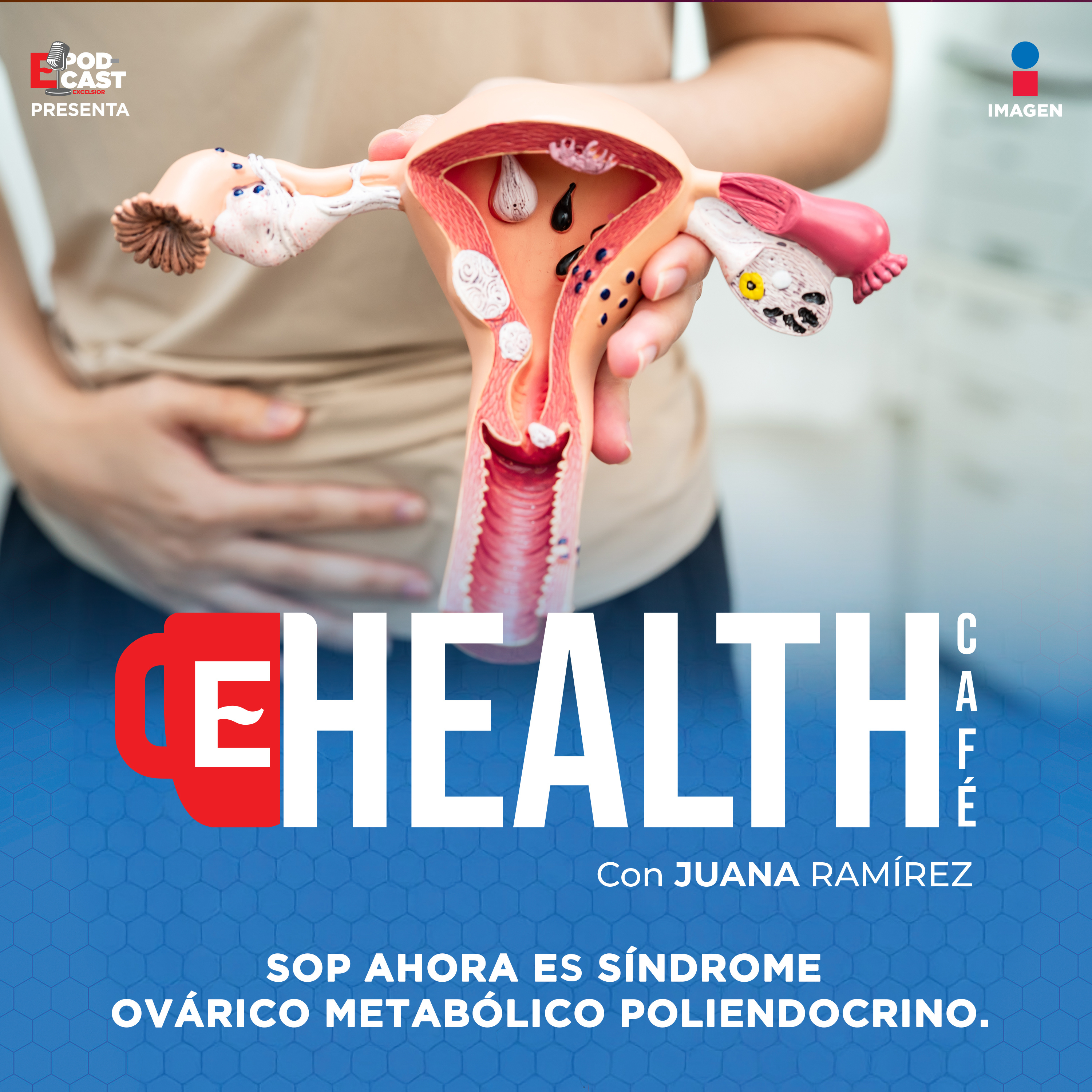 SOP: El Enemigo Silencioso de tu Metabolismo| Sindrome metabólico ovarico poliendócrino| T3 E40 episode artwork