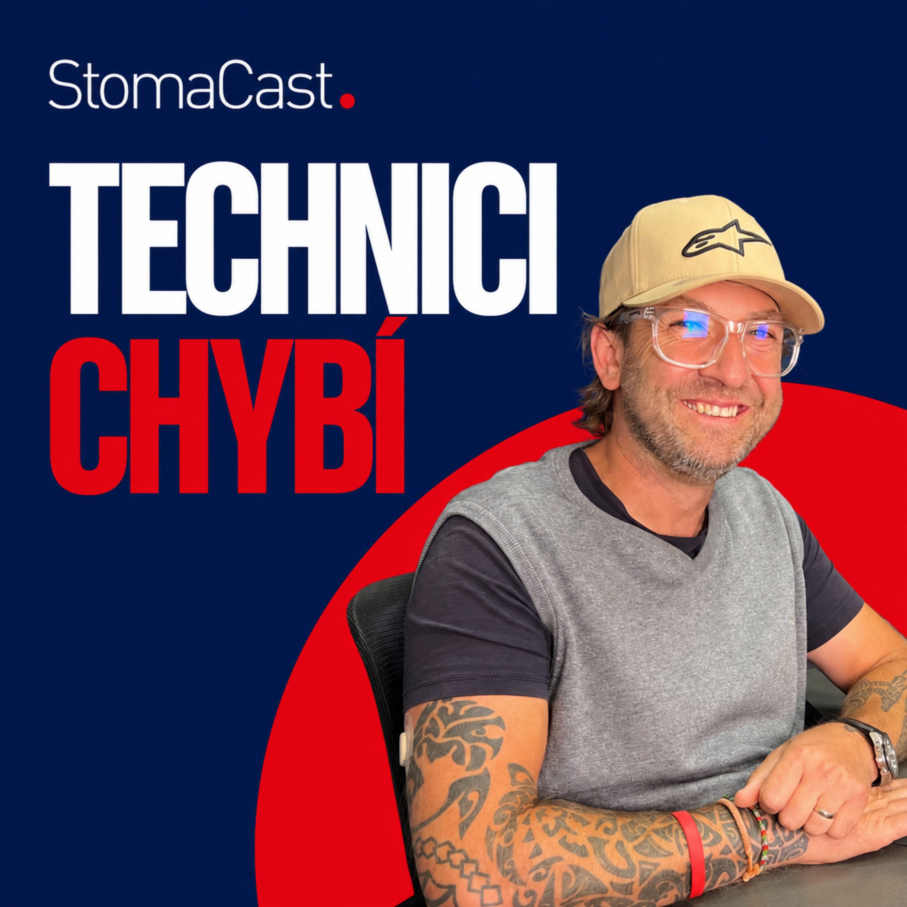 StomaCast