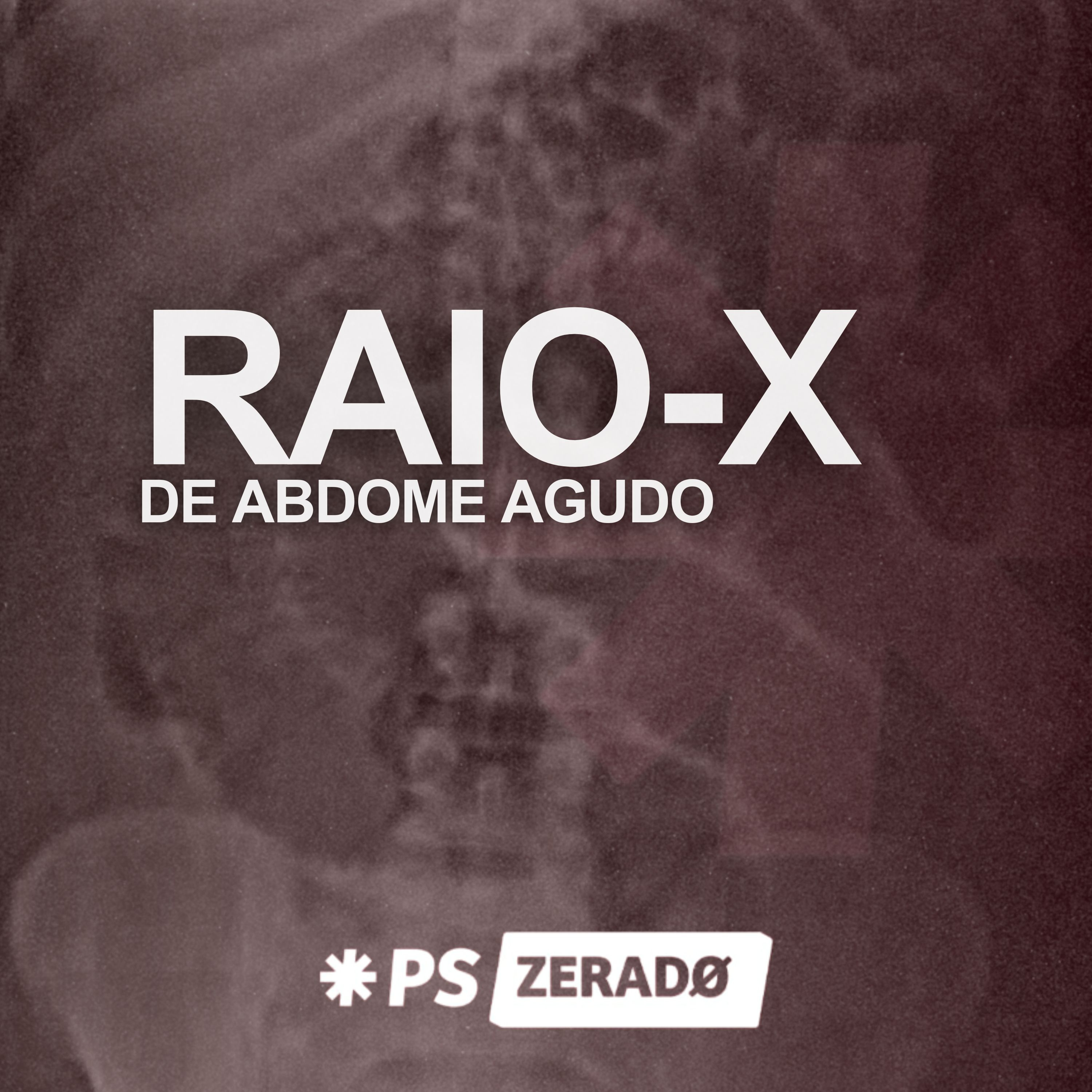 Raio-x de Abdome Agudo: você tem certeza que está pedindo certo? episode artwork