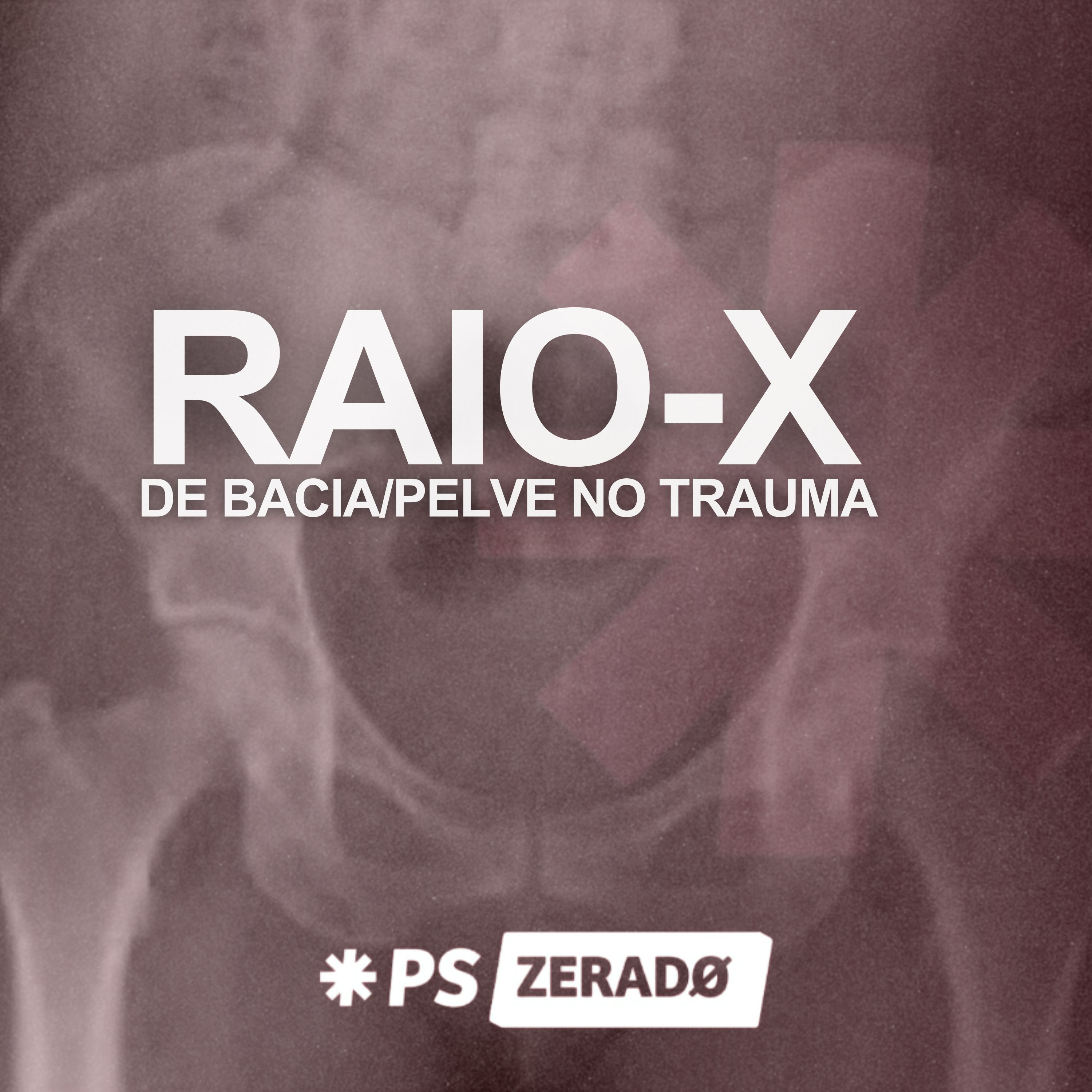 Raio-X de Bacia no Trauma: restrição e interpretação episode artwork