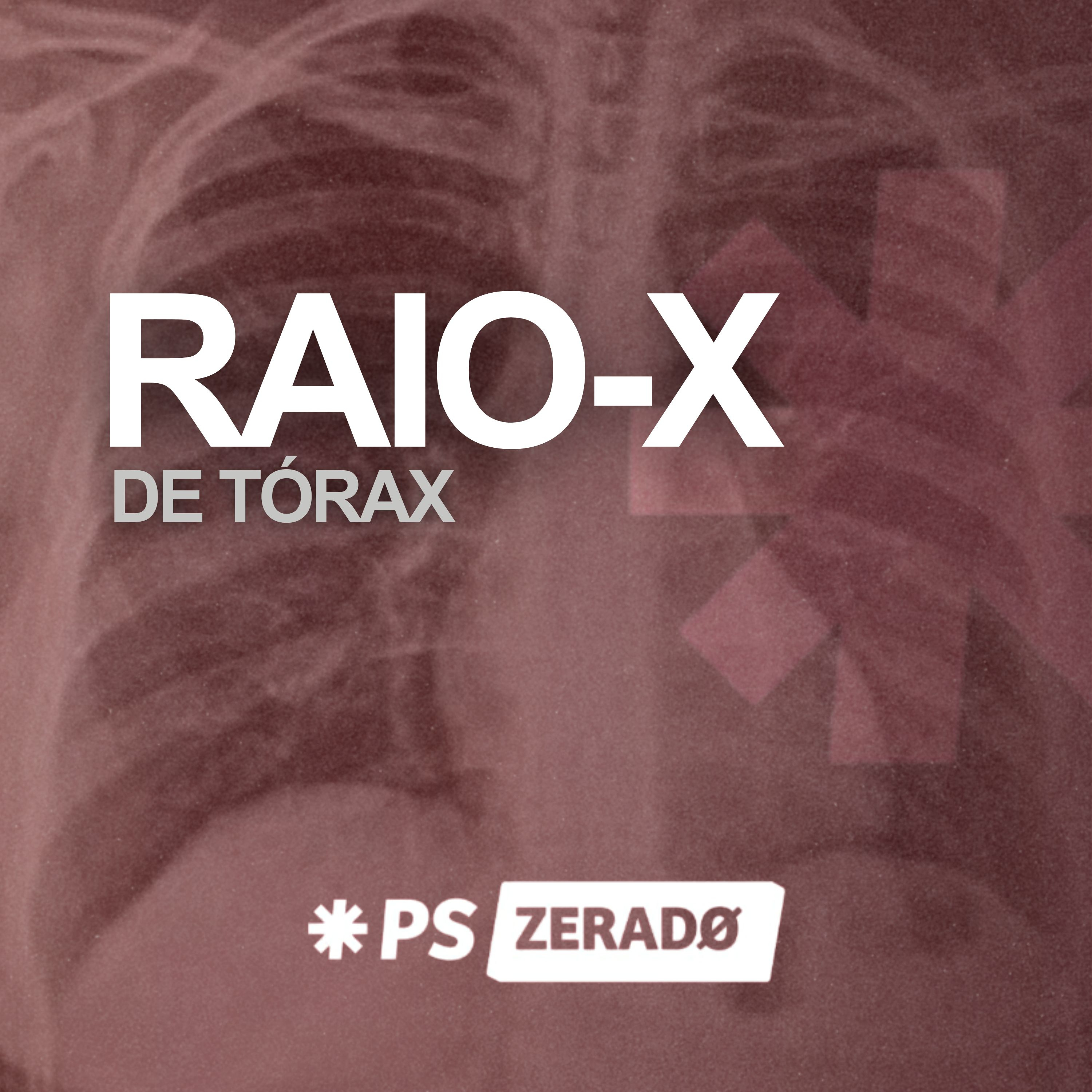Raio-X de Tórax no Plantão Sinais Clássicos sem Mistério episode artwork