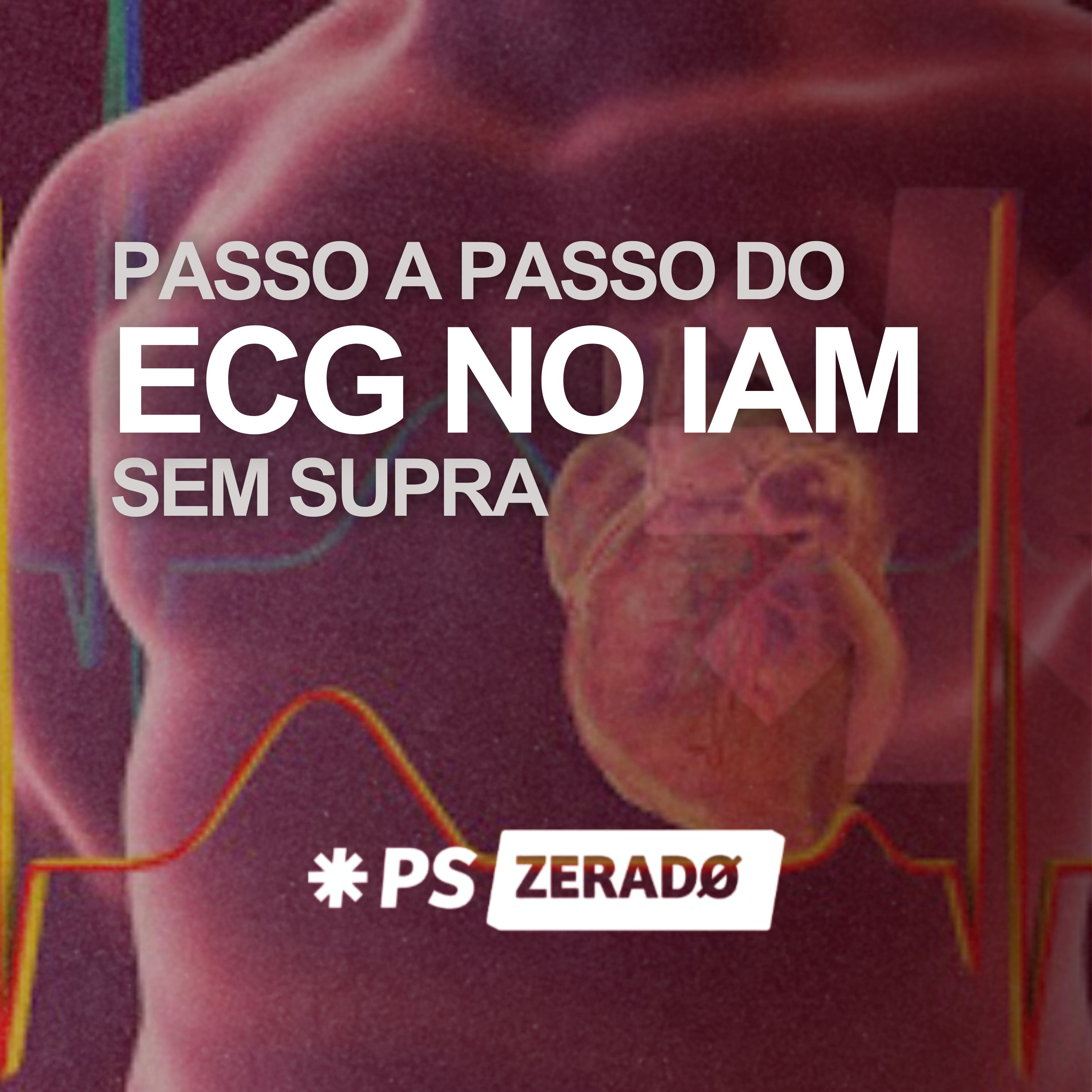 Eletrocardiograma IAMOCA episode artwork