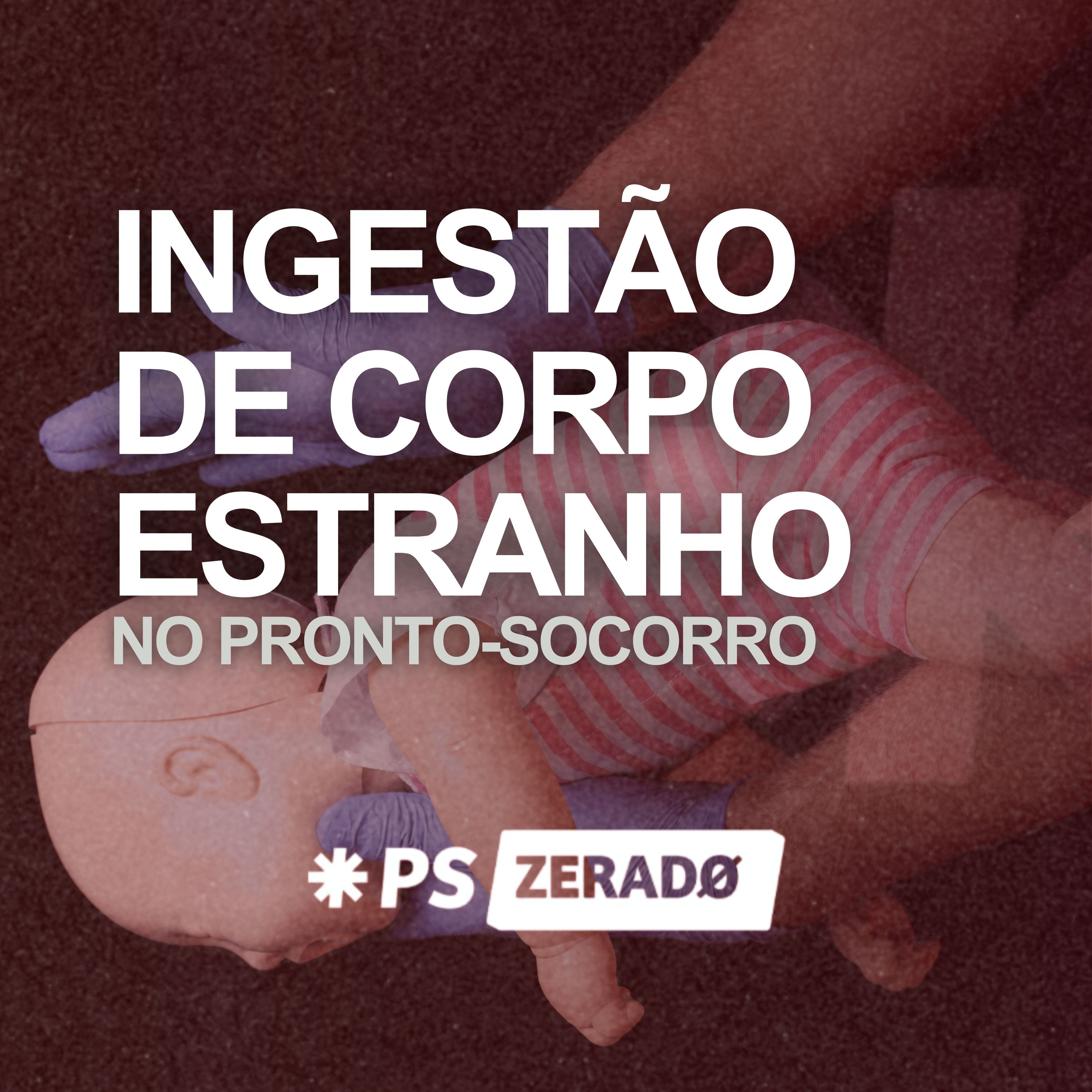 Ingestão de Corpo Estranho: O Que Fazer no PS