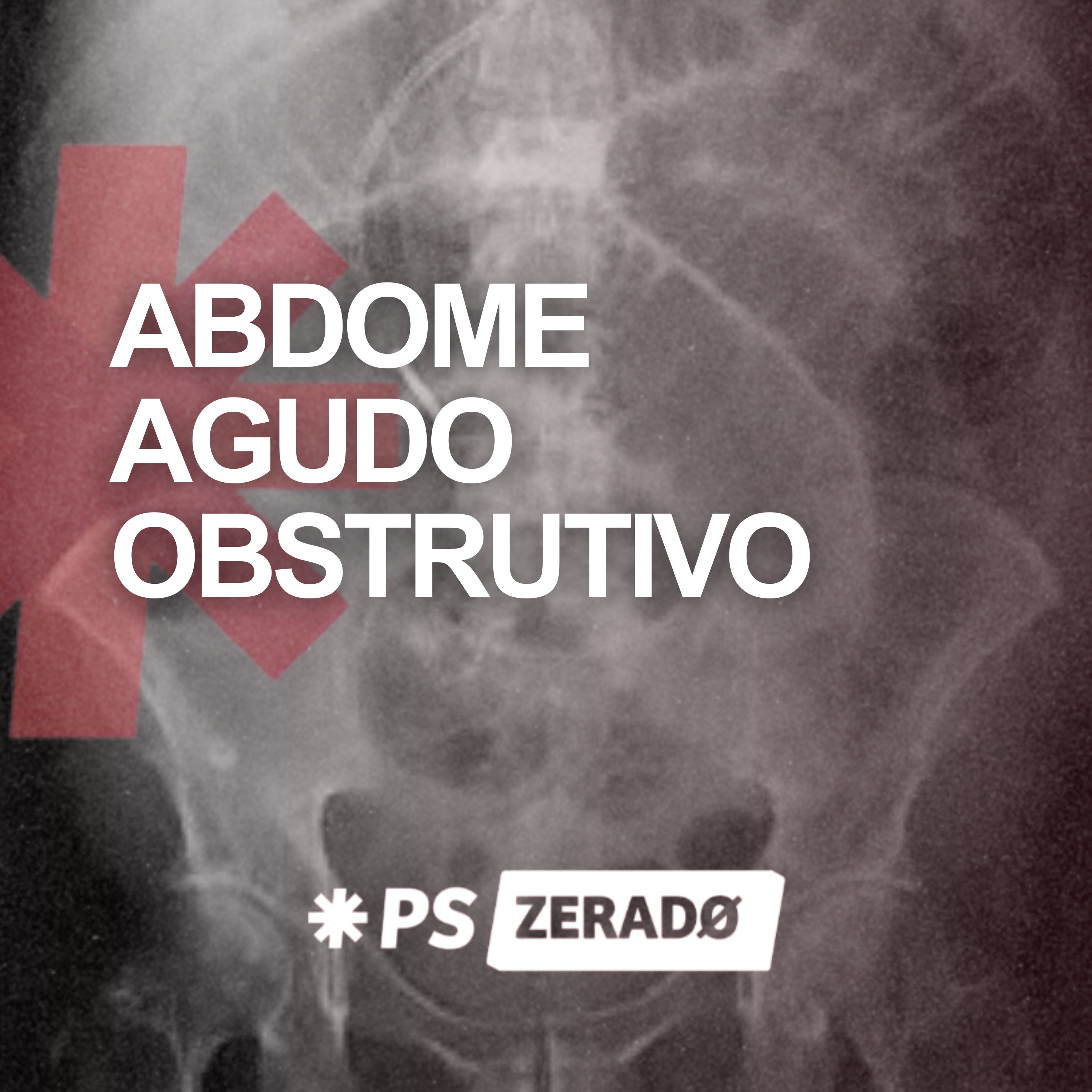 Abdome agudo obstrutivo: 3 etiologias, 3 exames, 3 condutas episode artwork