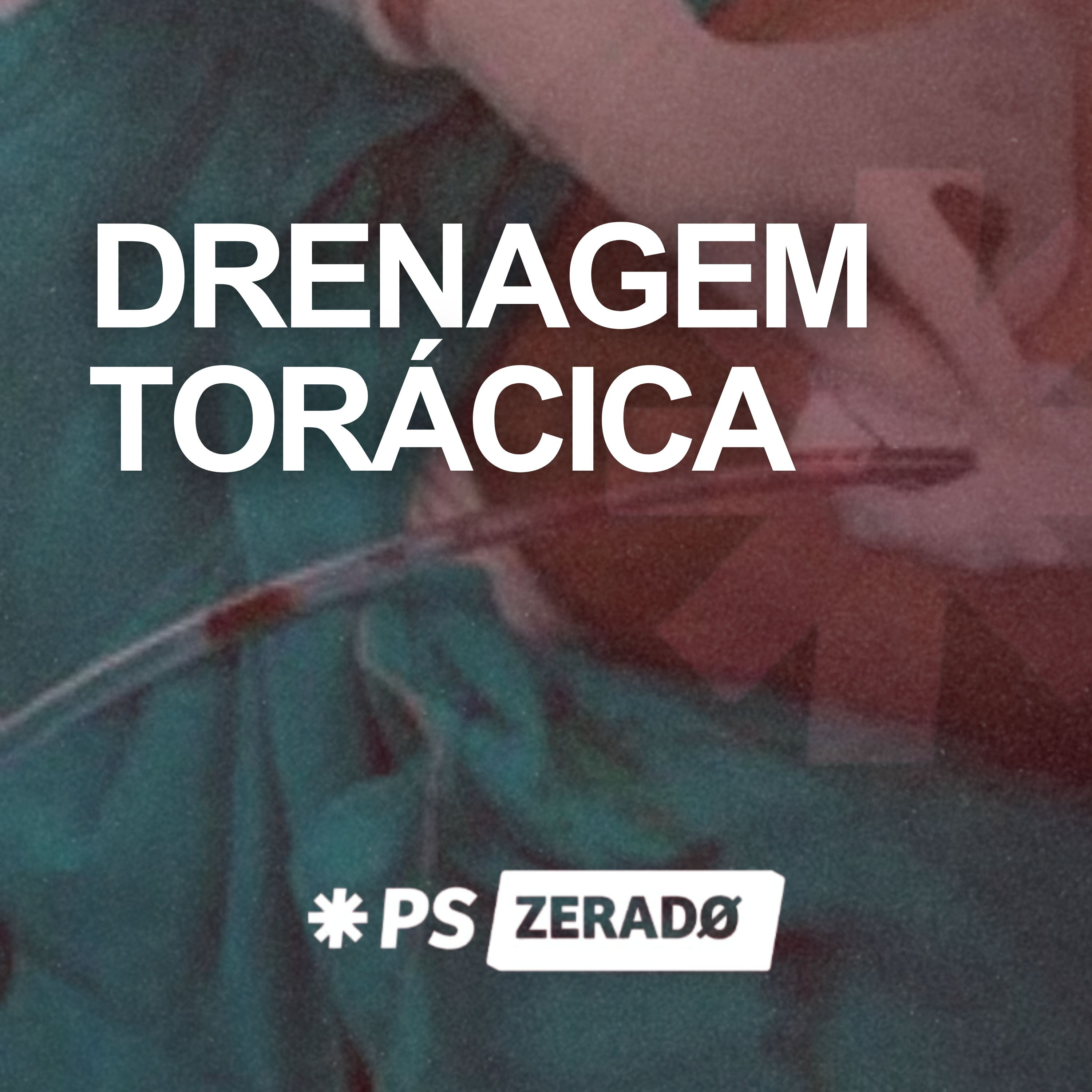 Drenagem torácica no paciente vigil: técnica e analgesia episode artwork
