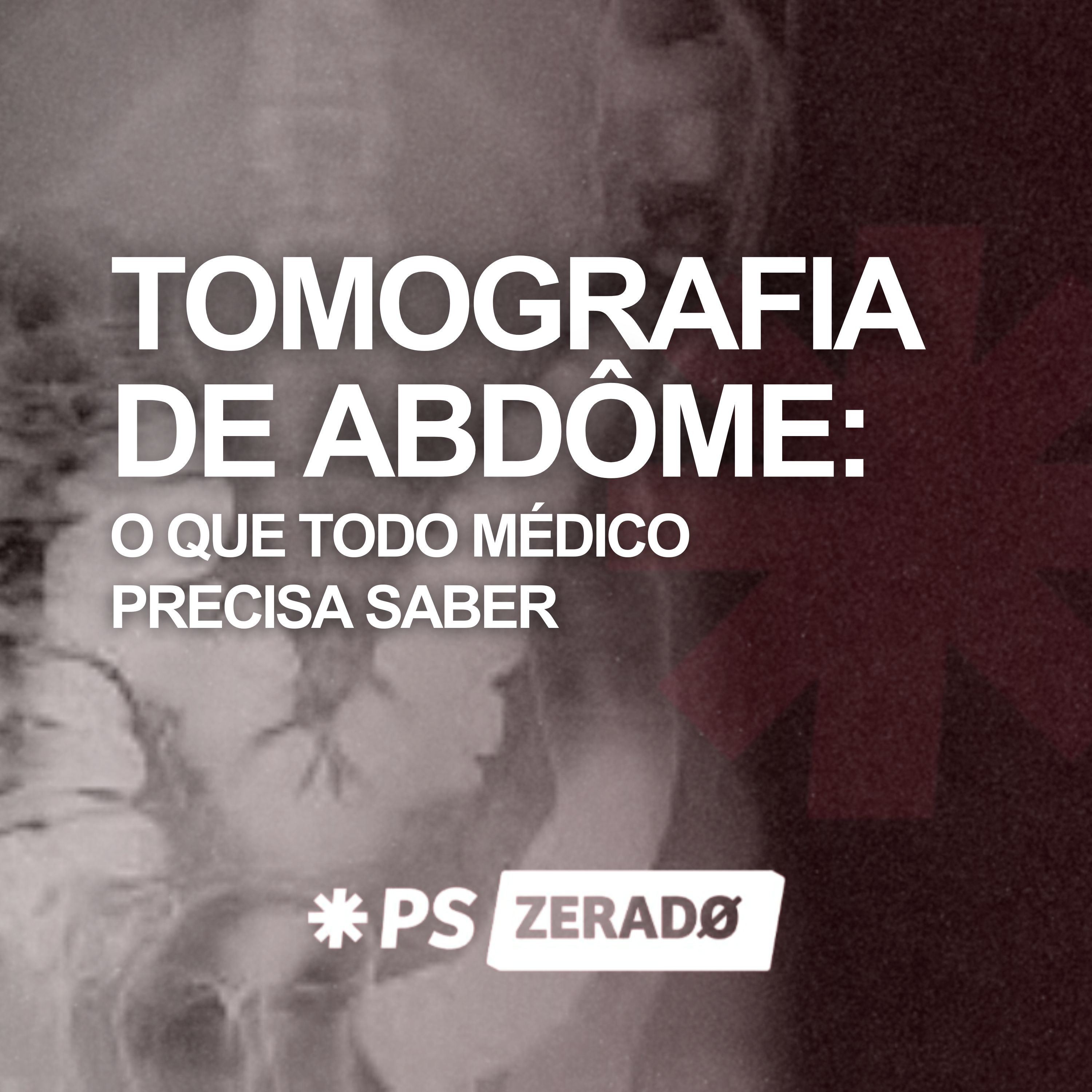 TC de Abdome: Indicação, Janelas e Contraste na Prática episode artwork
