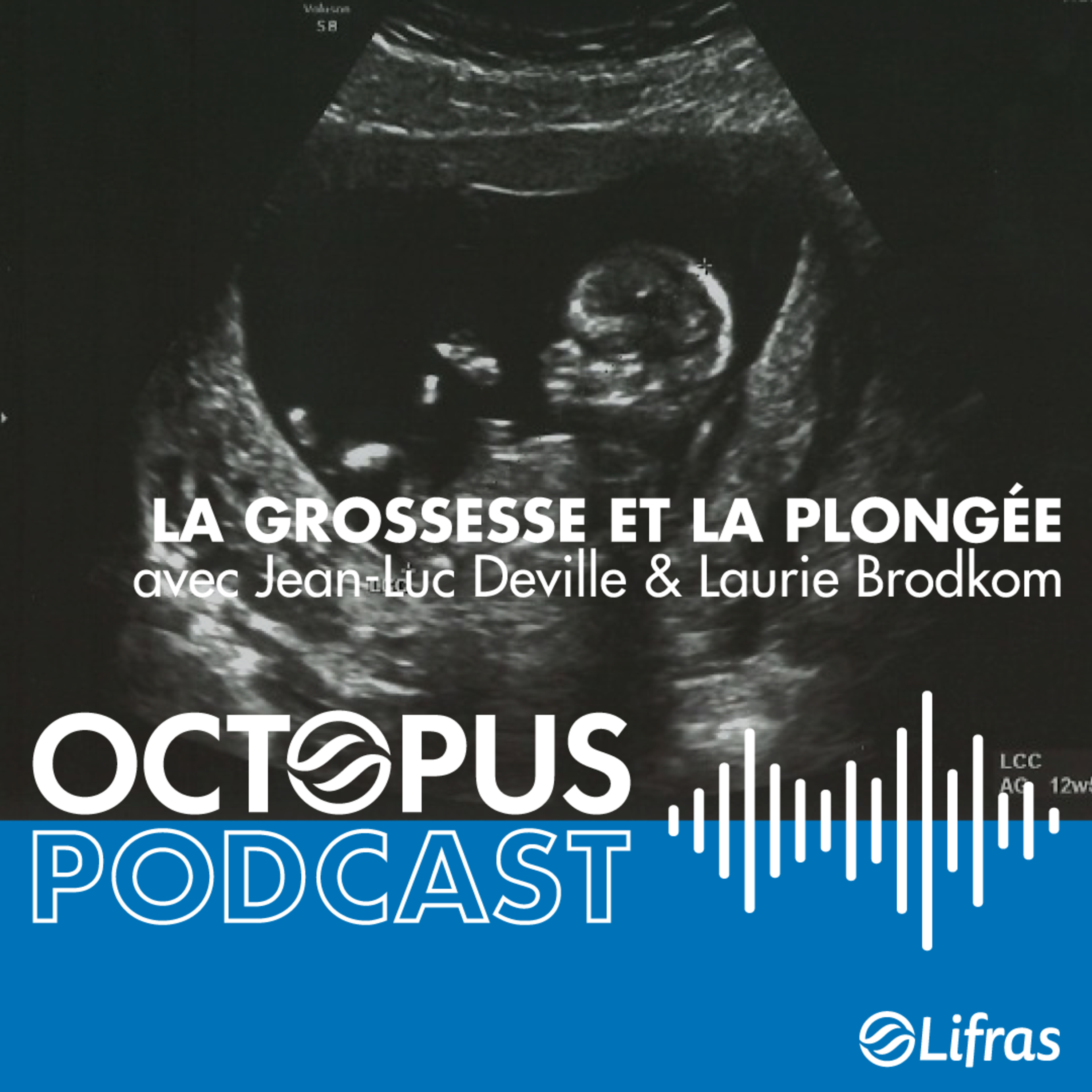 La grossesse et la plongée - avec Jean-Luc Deville & Laurie Brodkom episode artwork