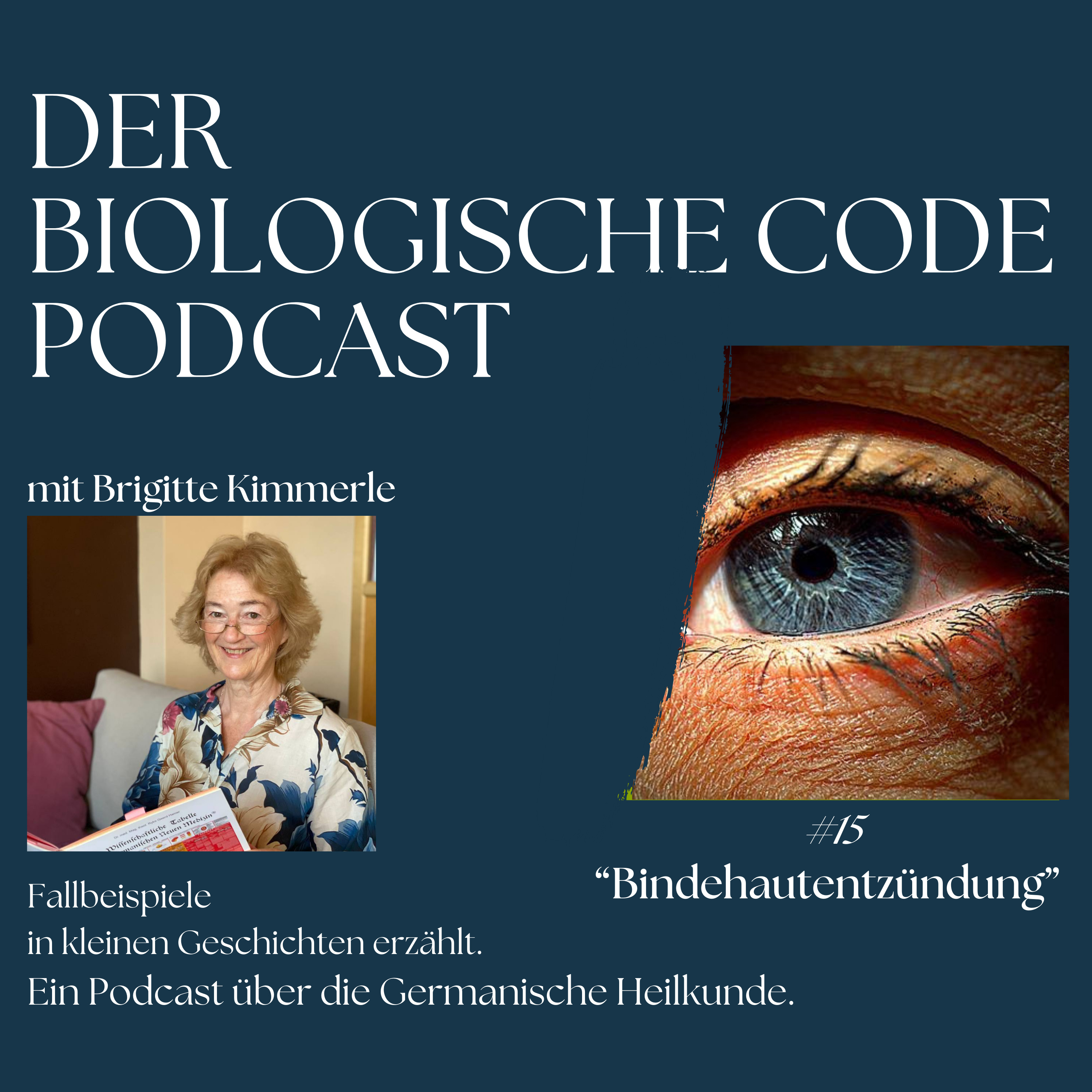 #15 - Bindehautentzündung