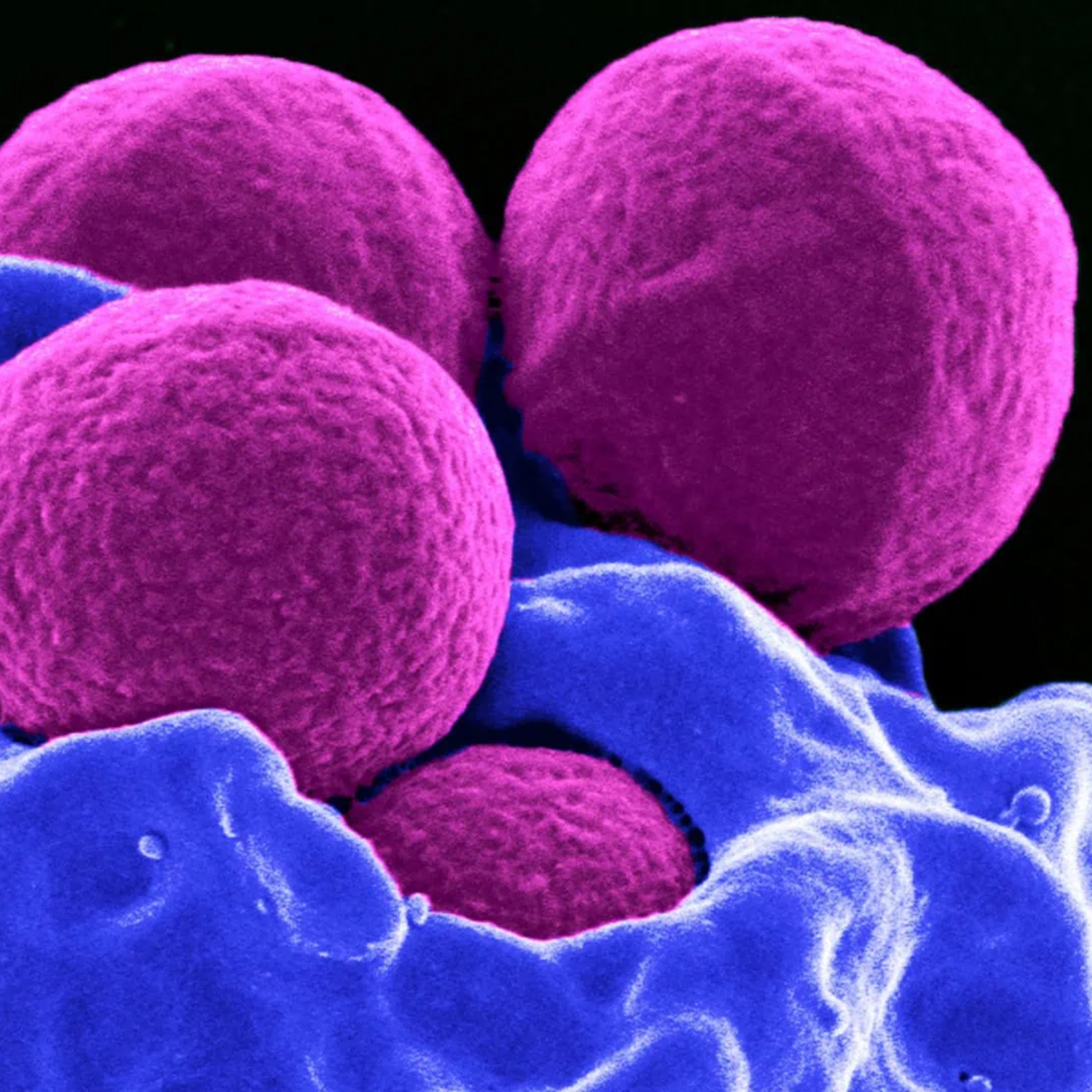 Episodio 17. Resistencia antibiótica en comunidades bacterianas marinas en Chile. episode artwork