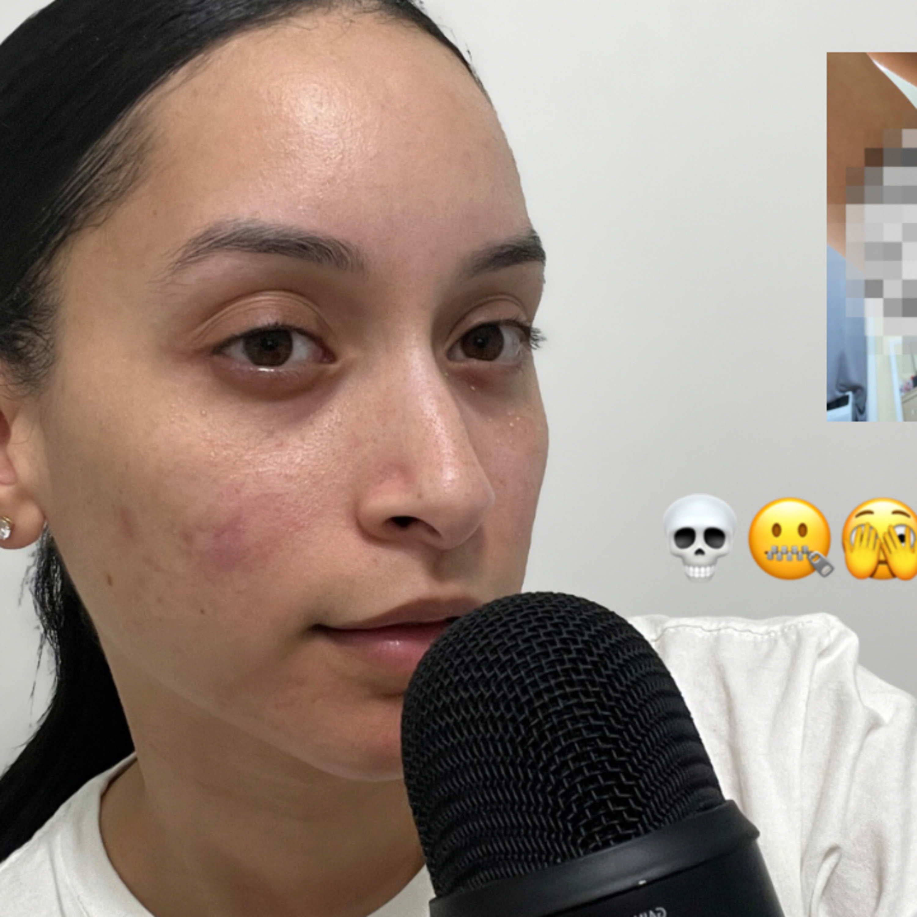 ASMR | Laser Hair Removal Gone Wrong