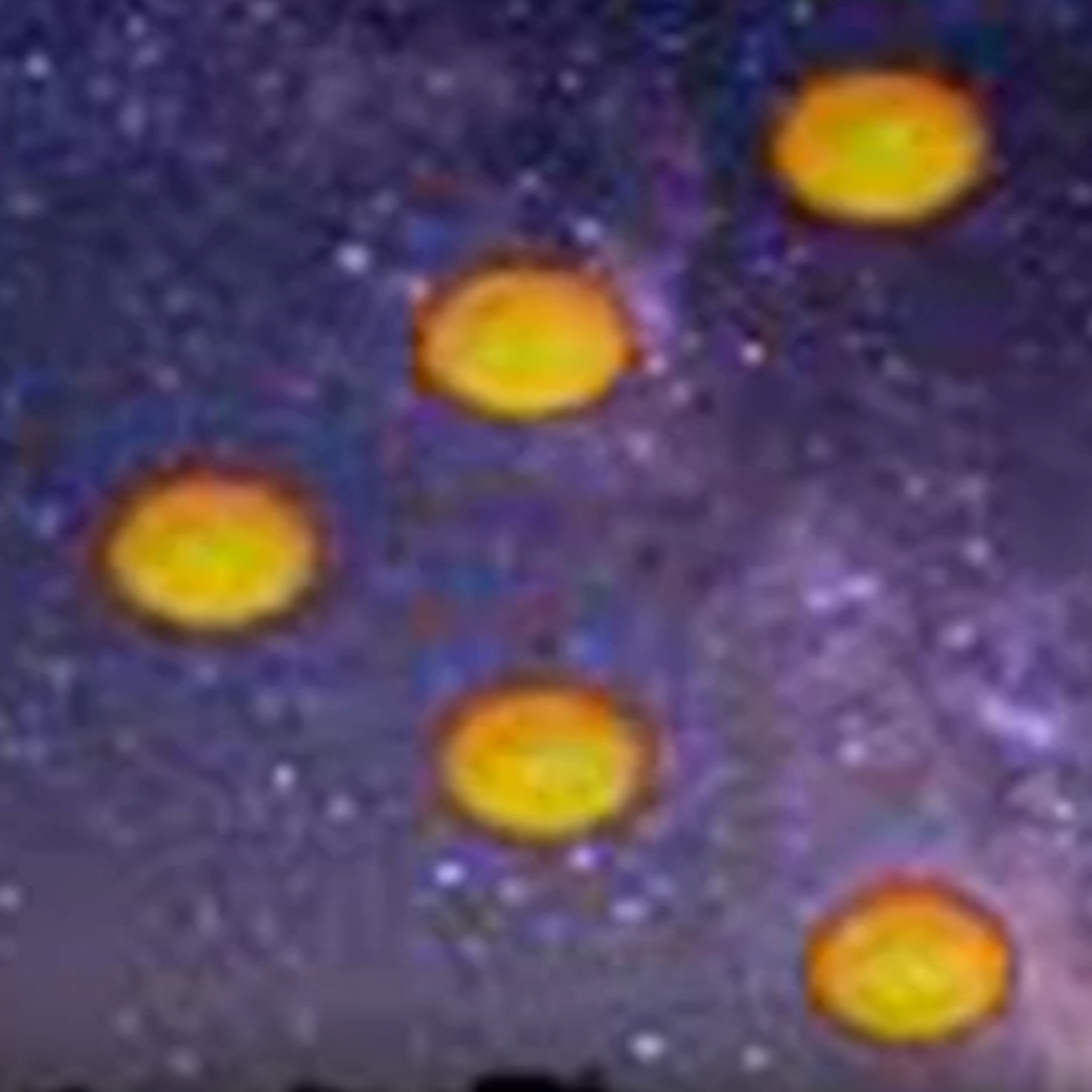 World Wide Invasion of the Orange Orbs | Terry Ray