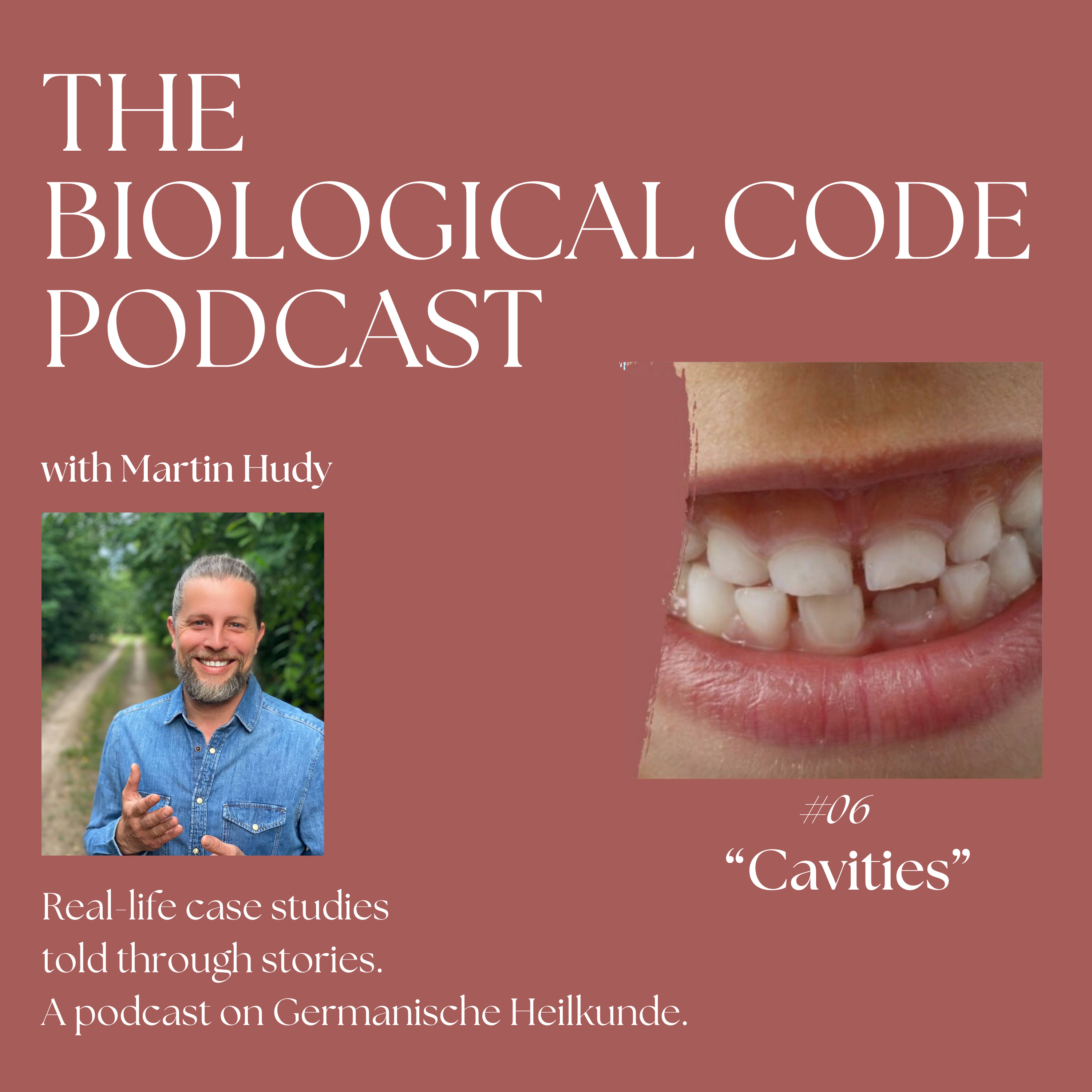 #6 Cavities episode artwork