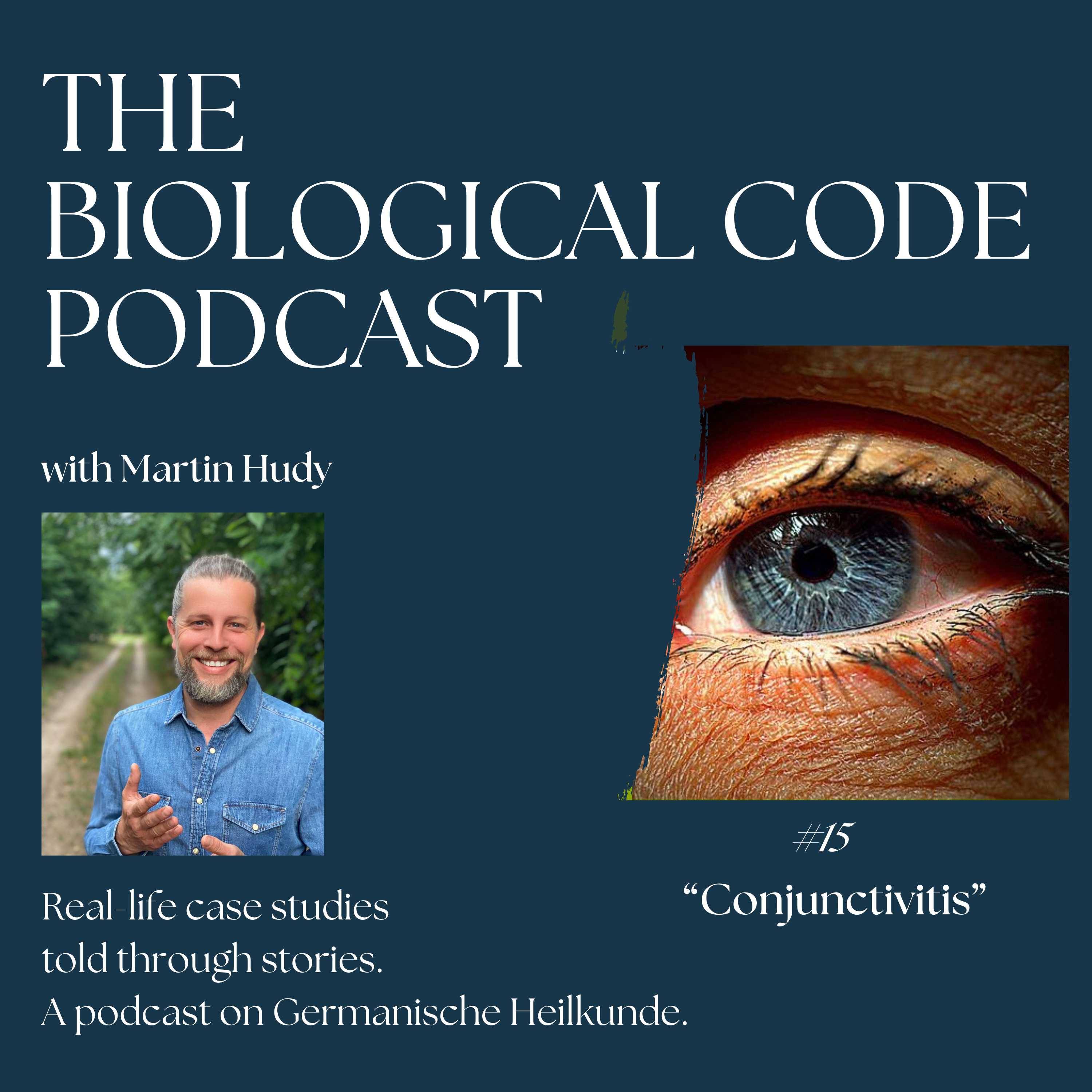 #15 - Conjunctivitis episode artwork