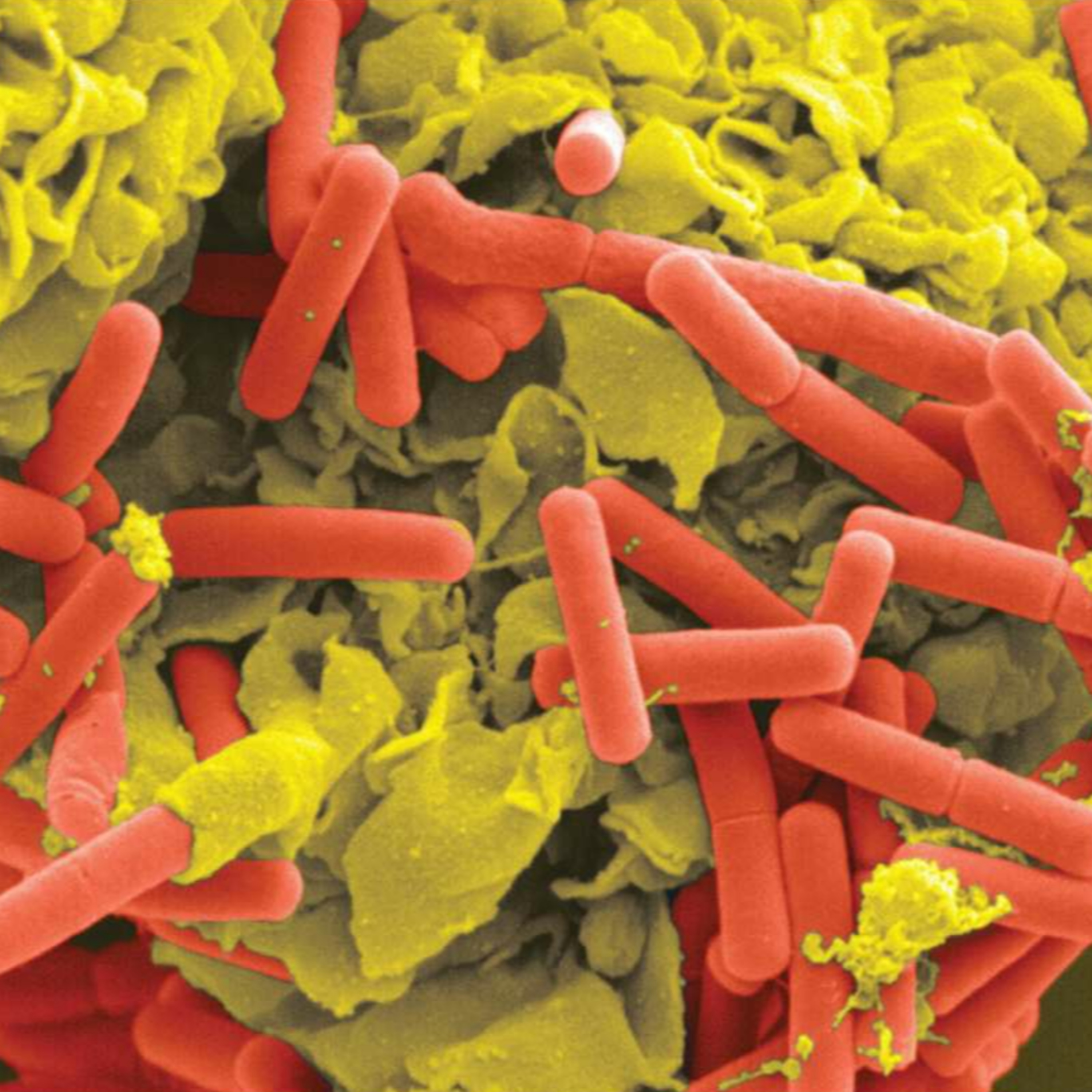 Innate Immunity (immunology part 4)