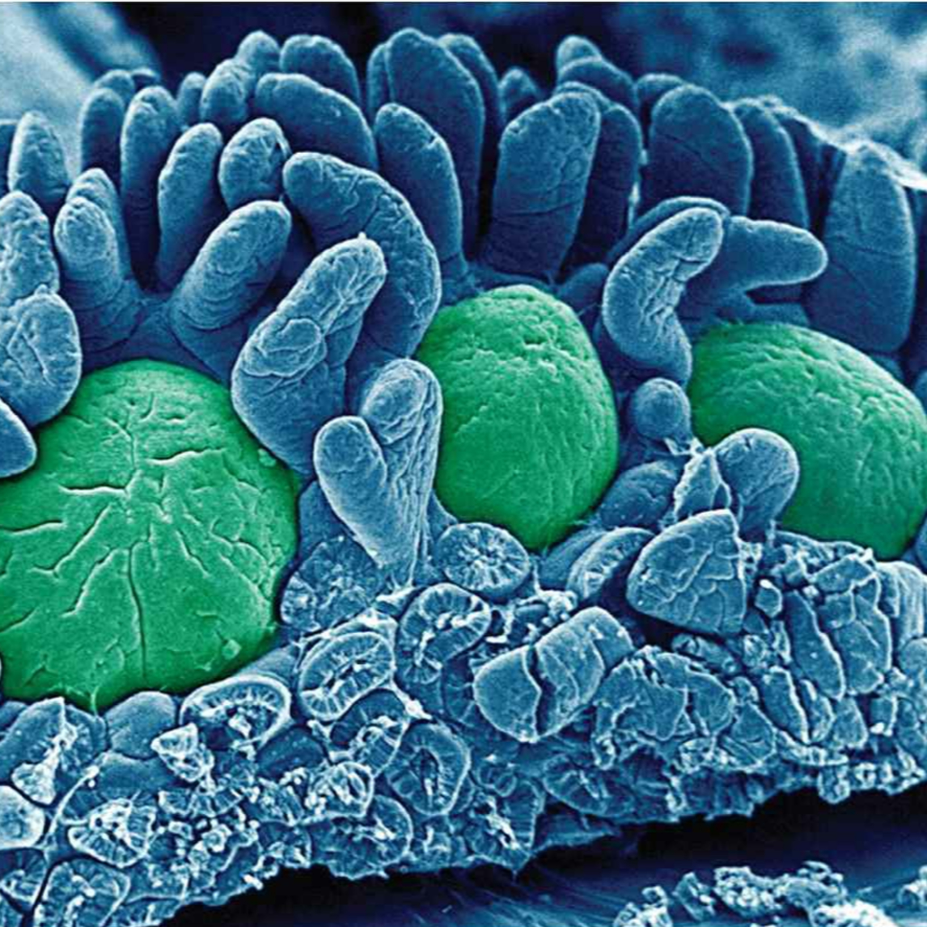 Barrier Immunity: The Immunology of Mucosa and Skin( immunology part 13)