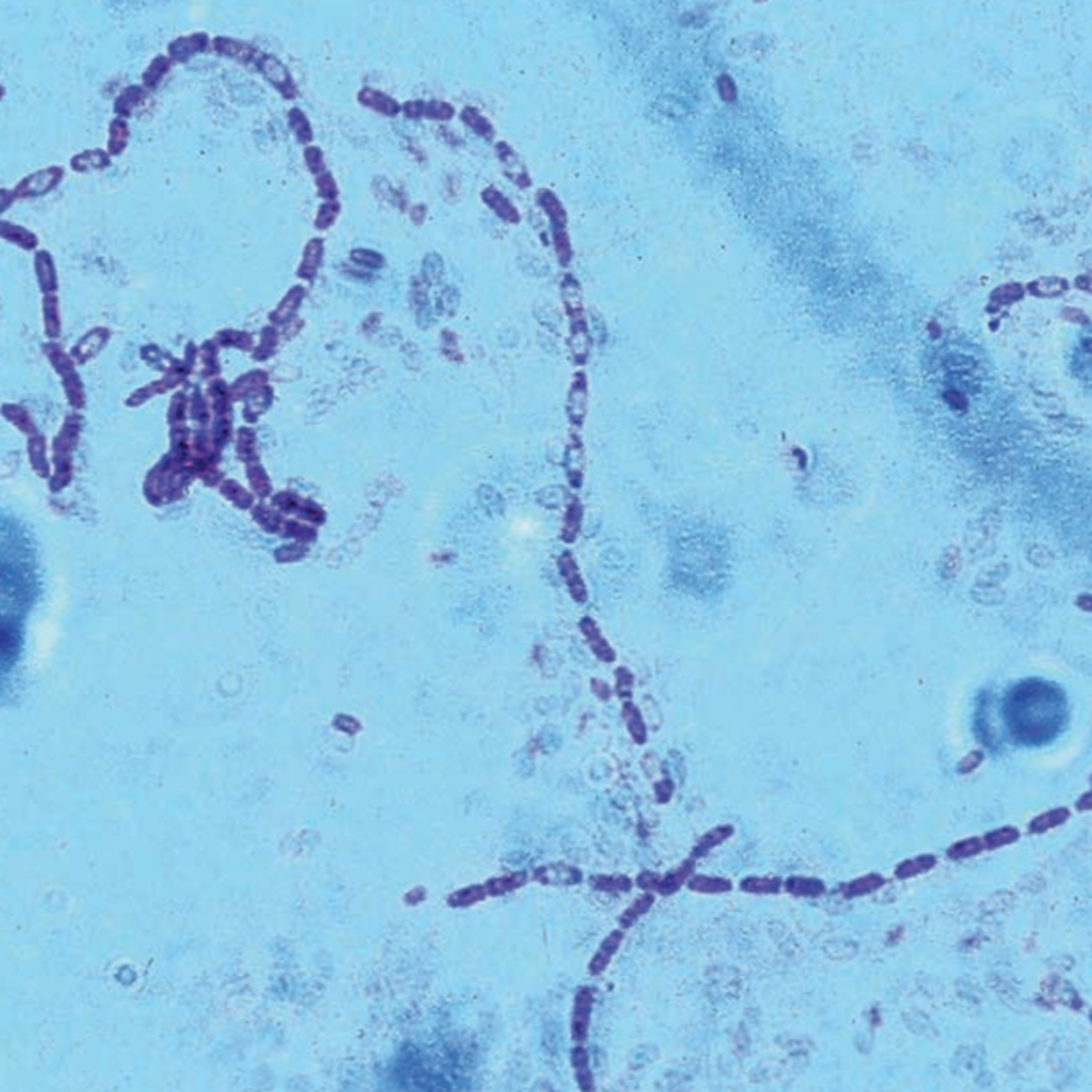 Major Shifts in Bacterial Transcription (CMB part 6)