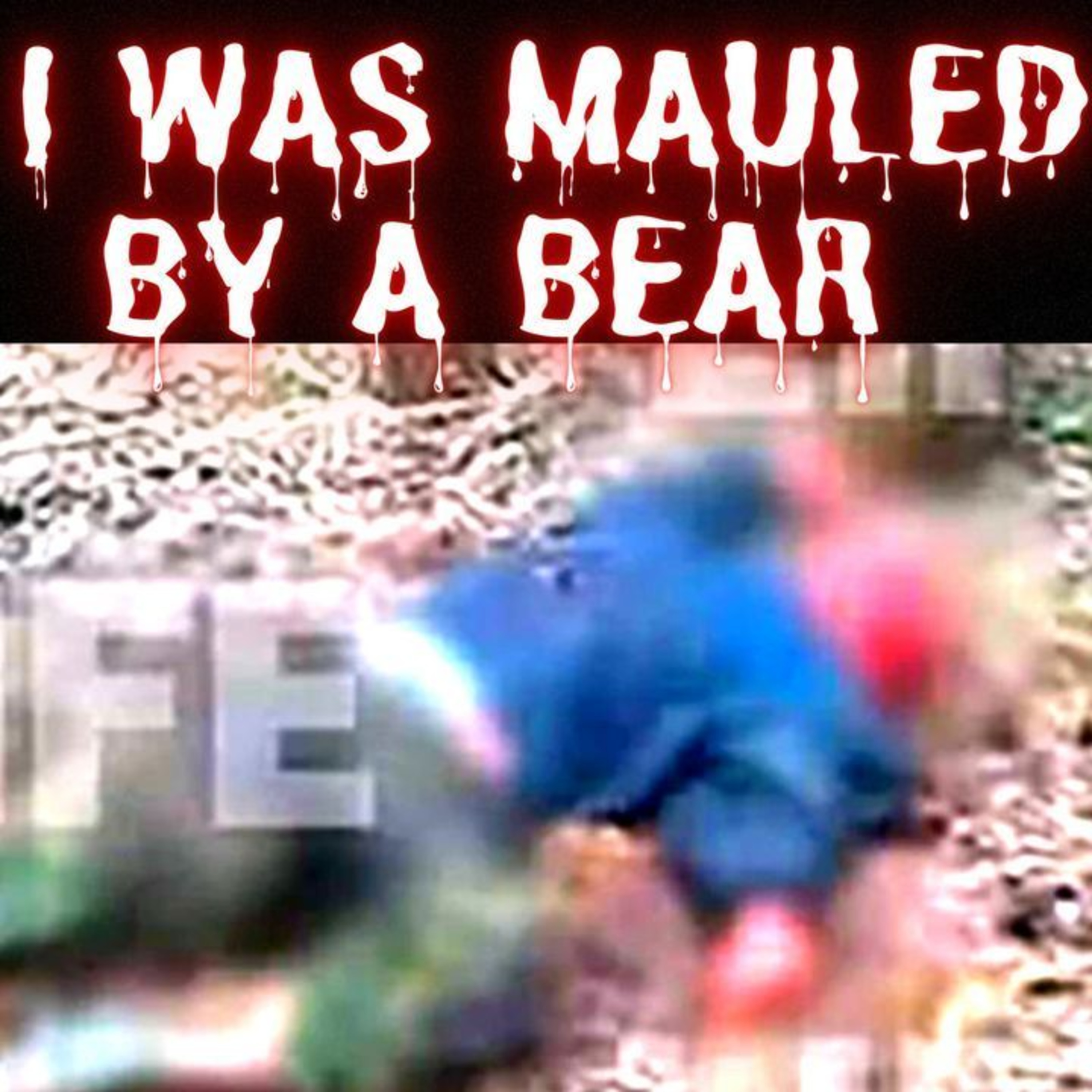 I was mauled by a bear and I fought it off. Ask Me Anything!