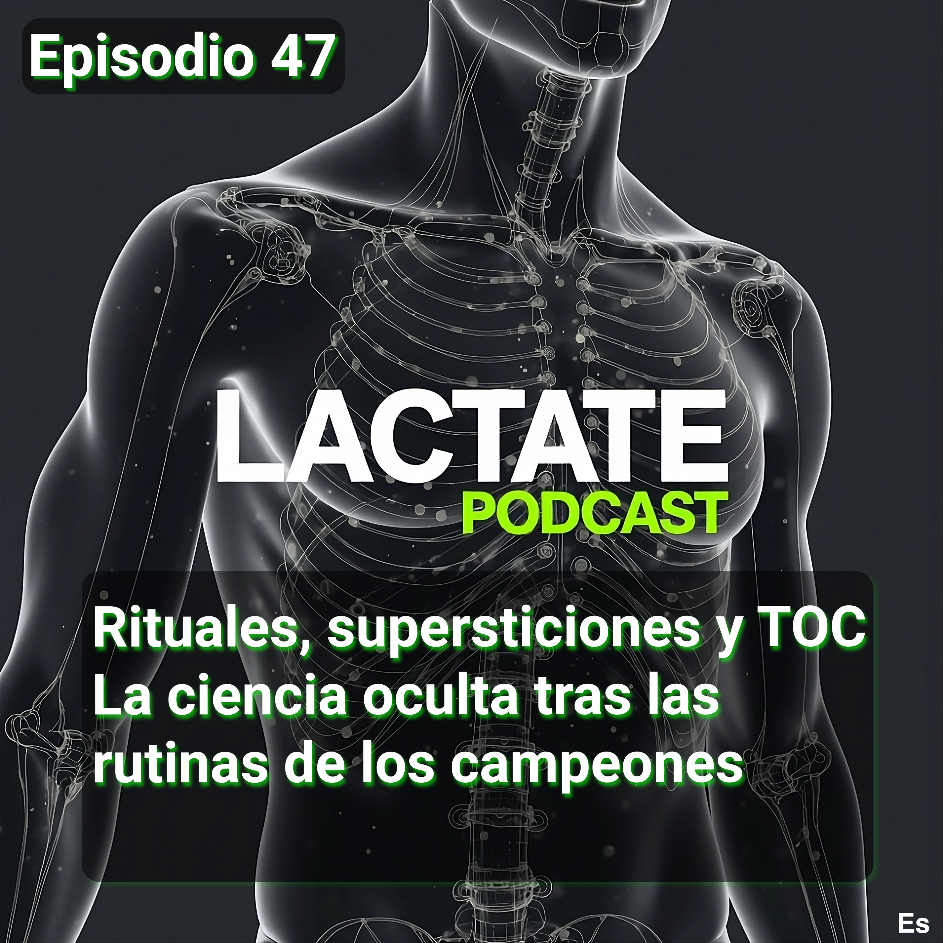 LACTATE (es)
