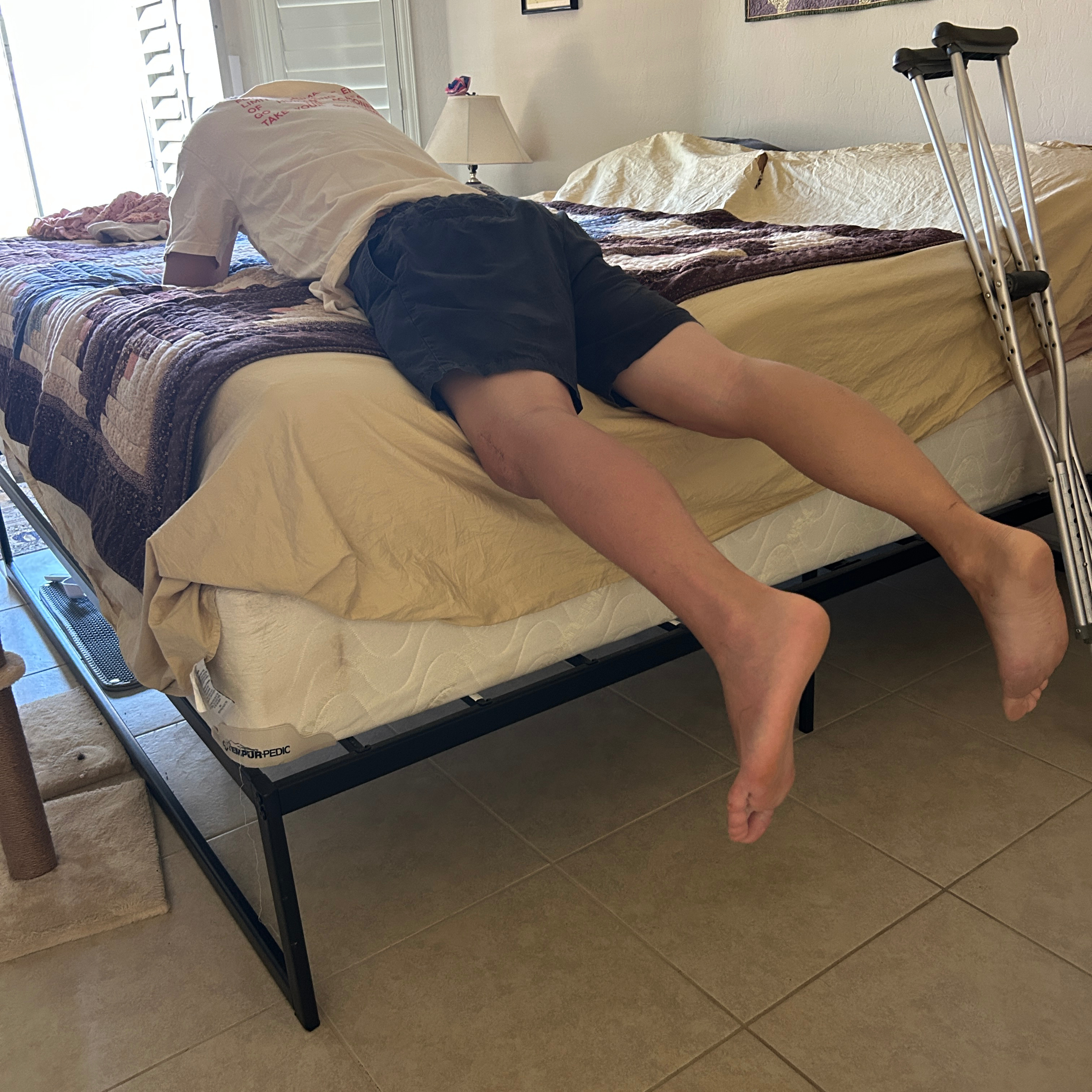 34. Week 6 acl+meniscus post surgery: no restrictions/ 6-month milestone episode artwork