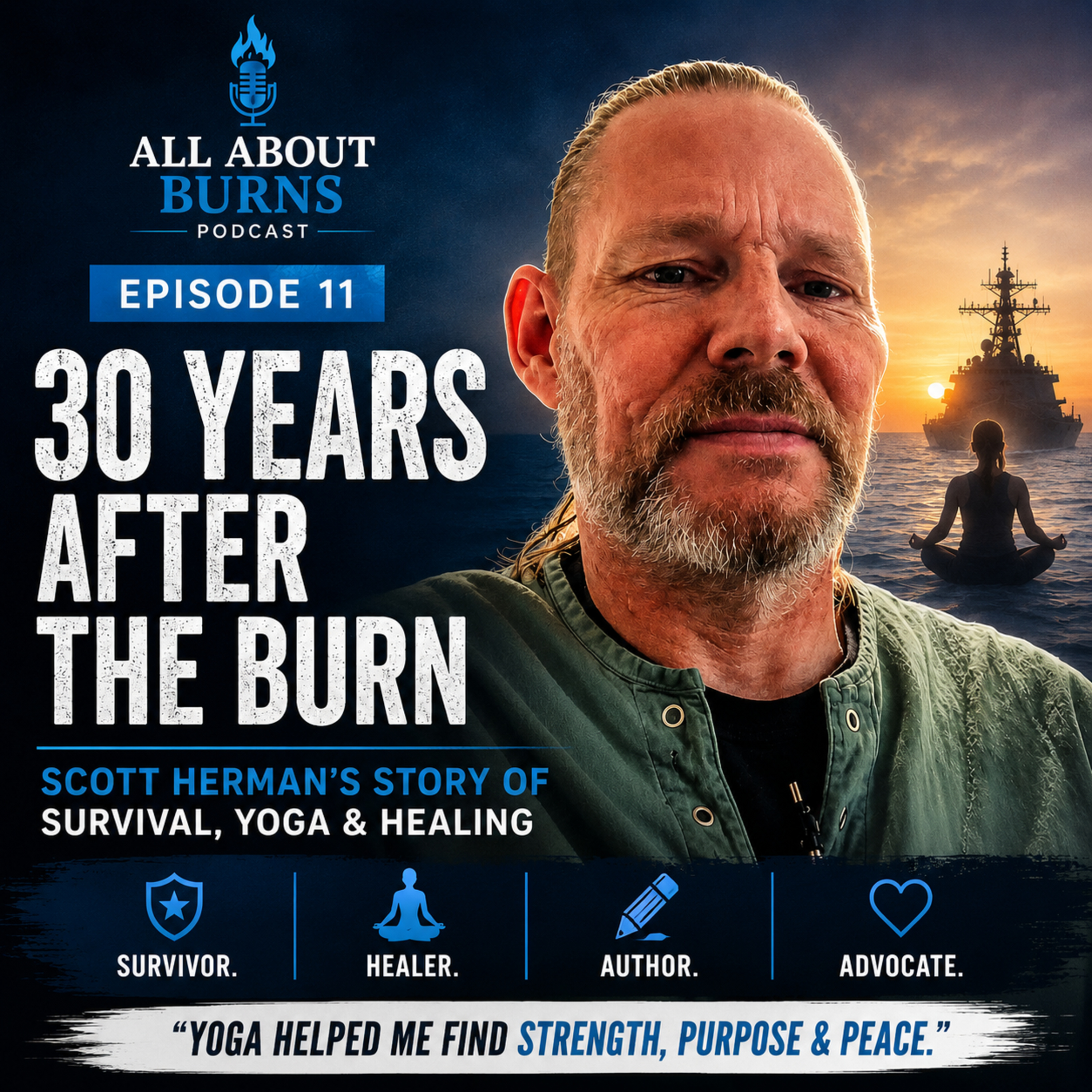 All About Burns