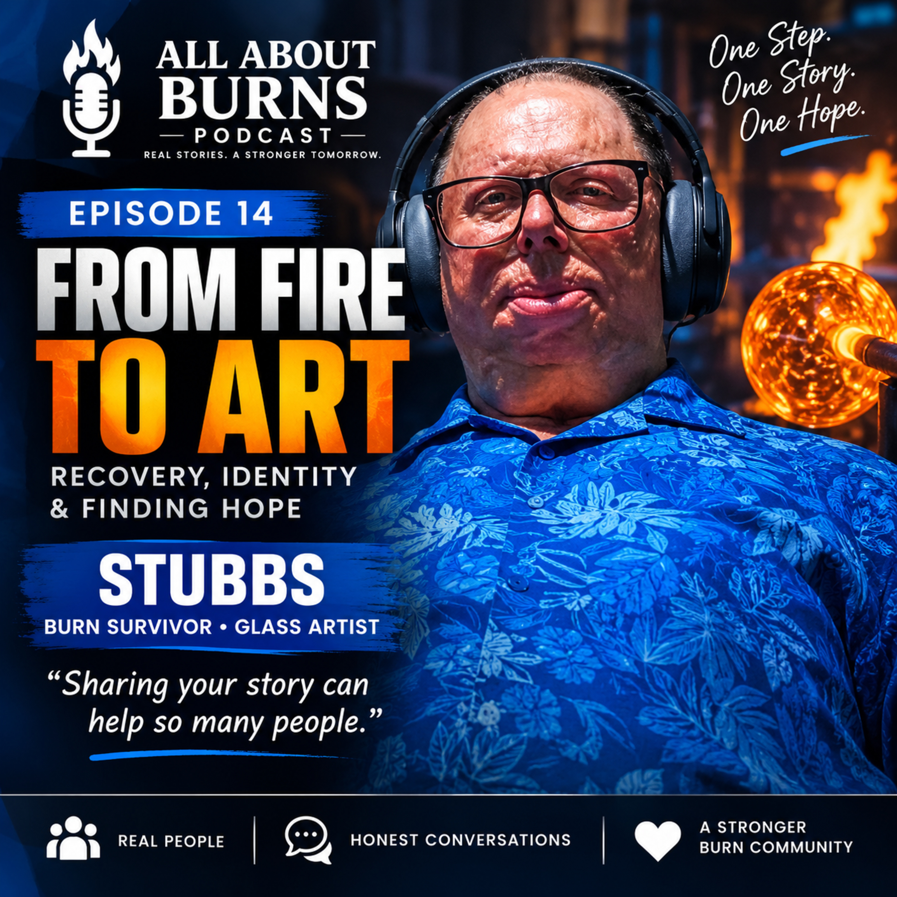 All About Burns