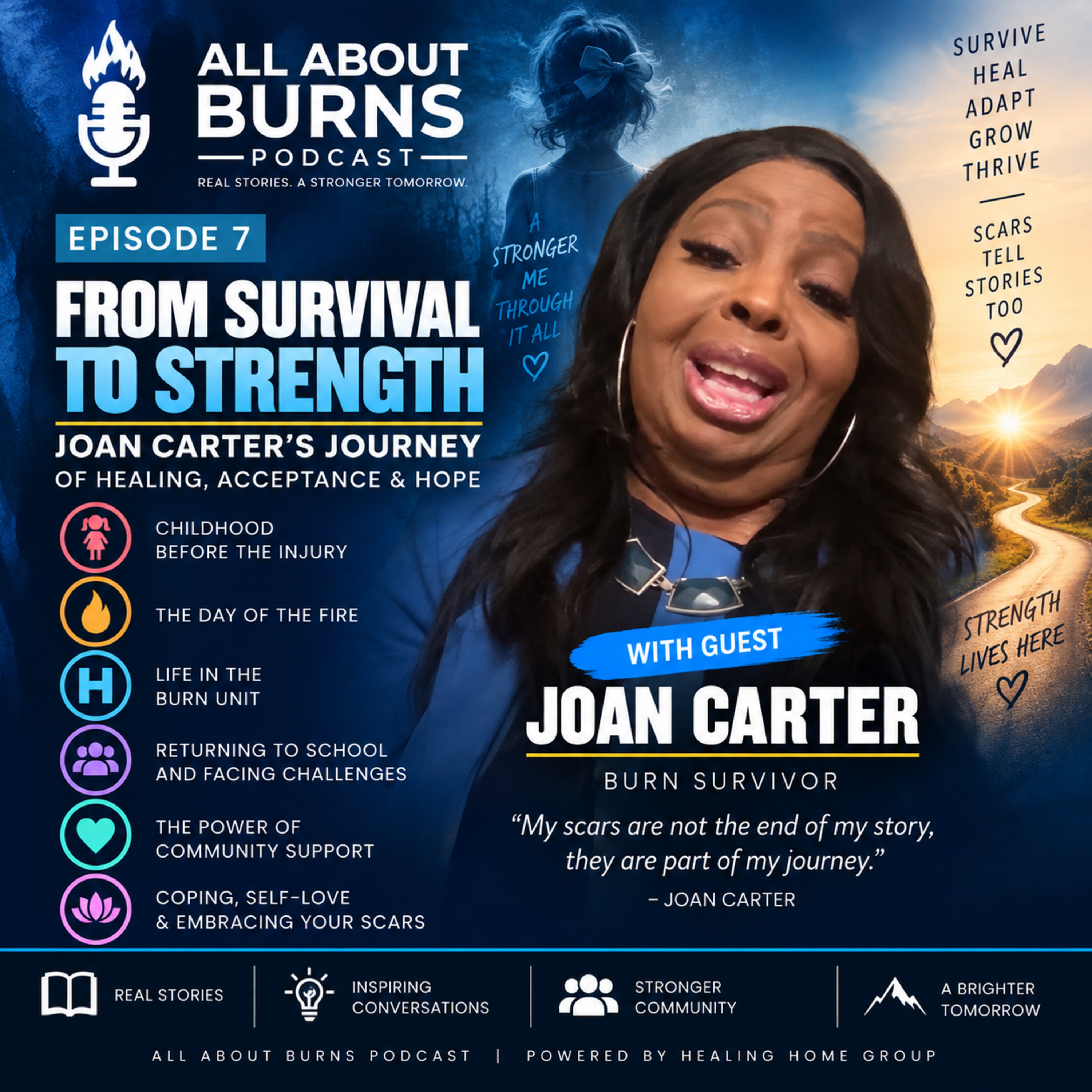All About Burns