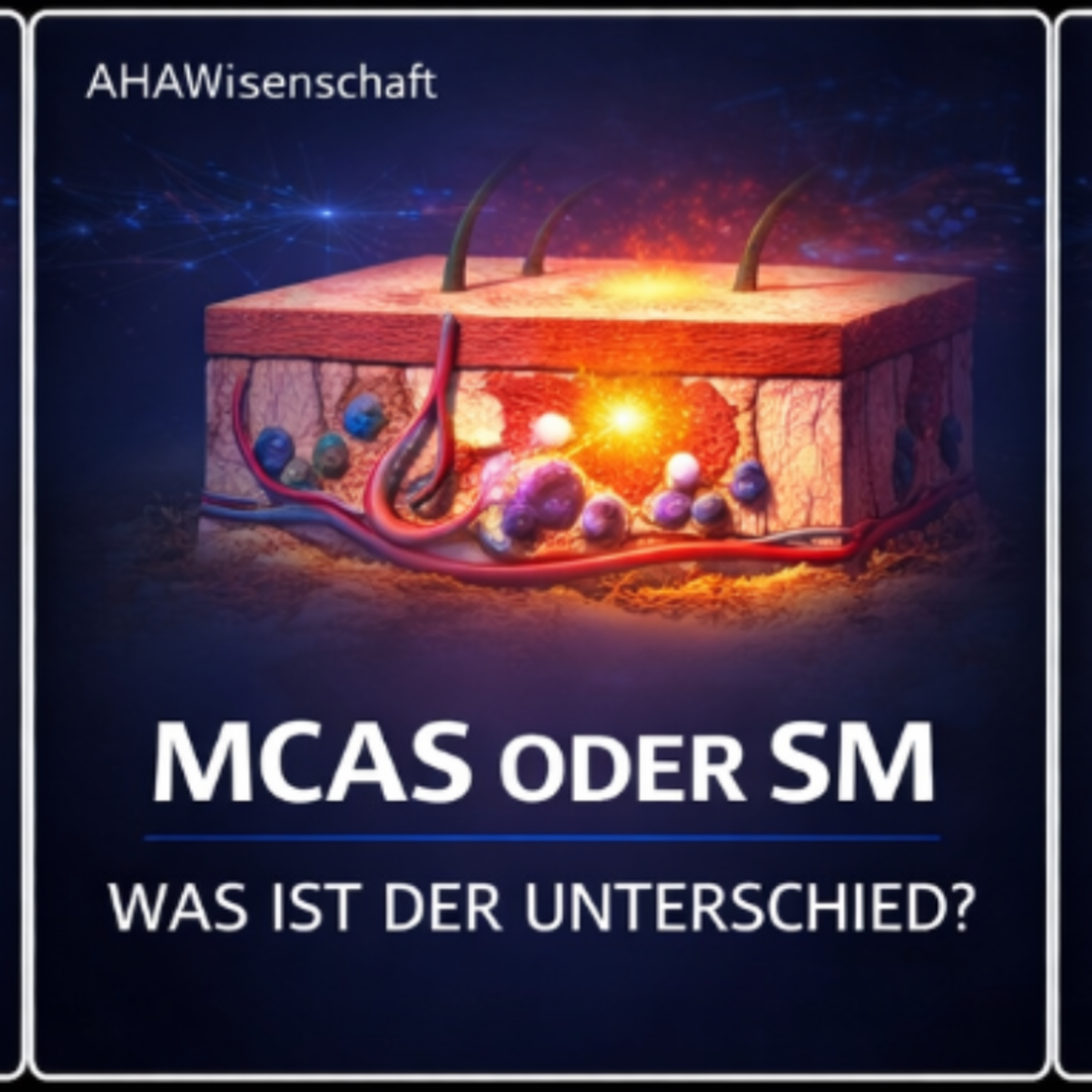 MCAS oder Systemische Mastozytose: Was ist der Unterschied bei Mastzellerkrankungen episode artwork