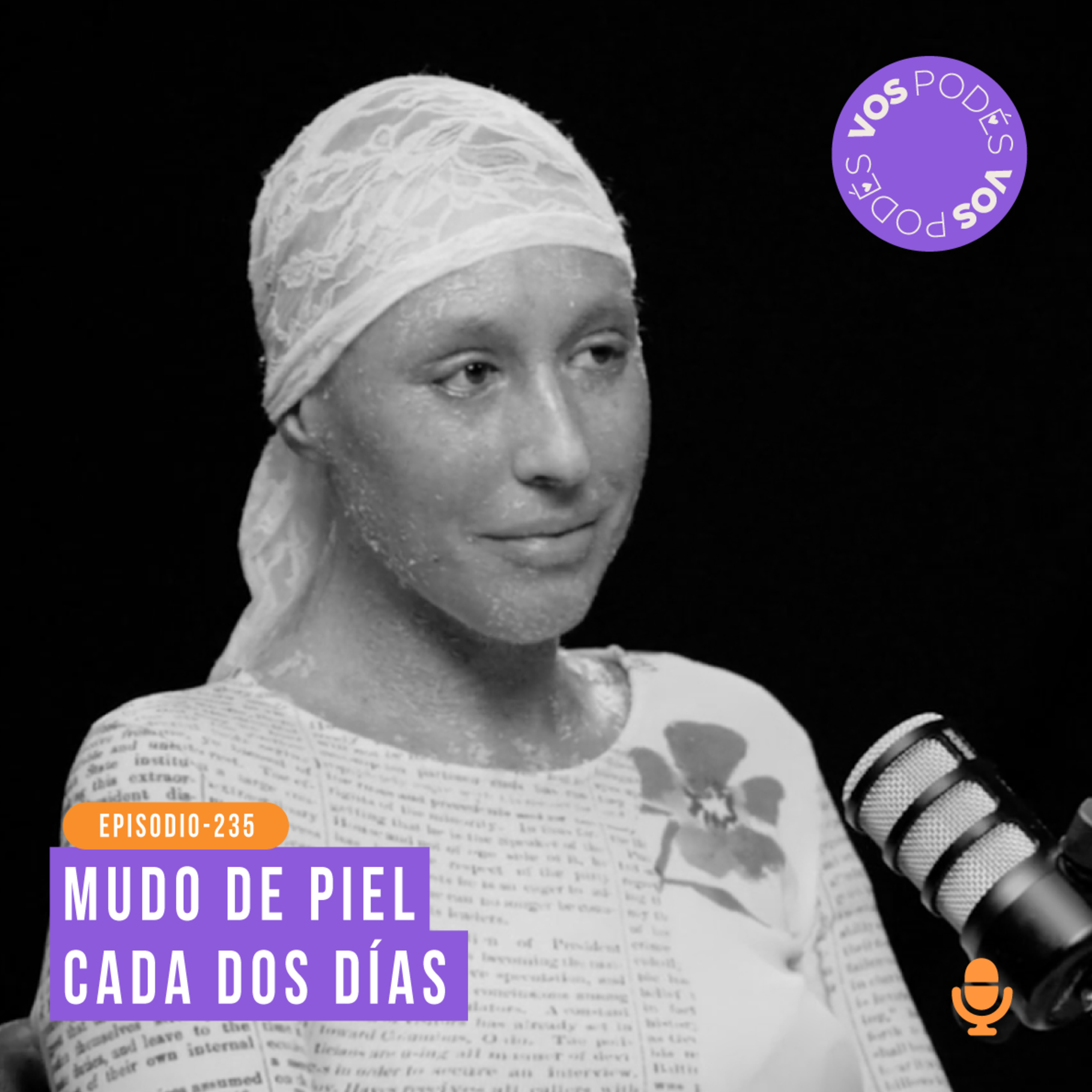 Va dejando piel muerta por donde pasa: Invitada - Vivian Baquero