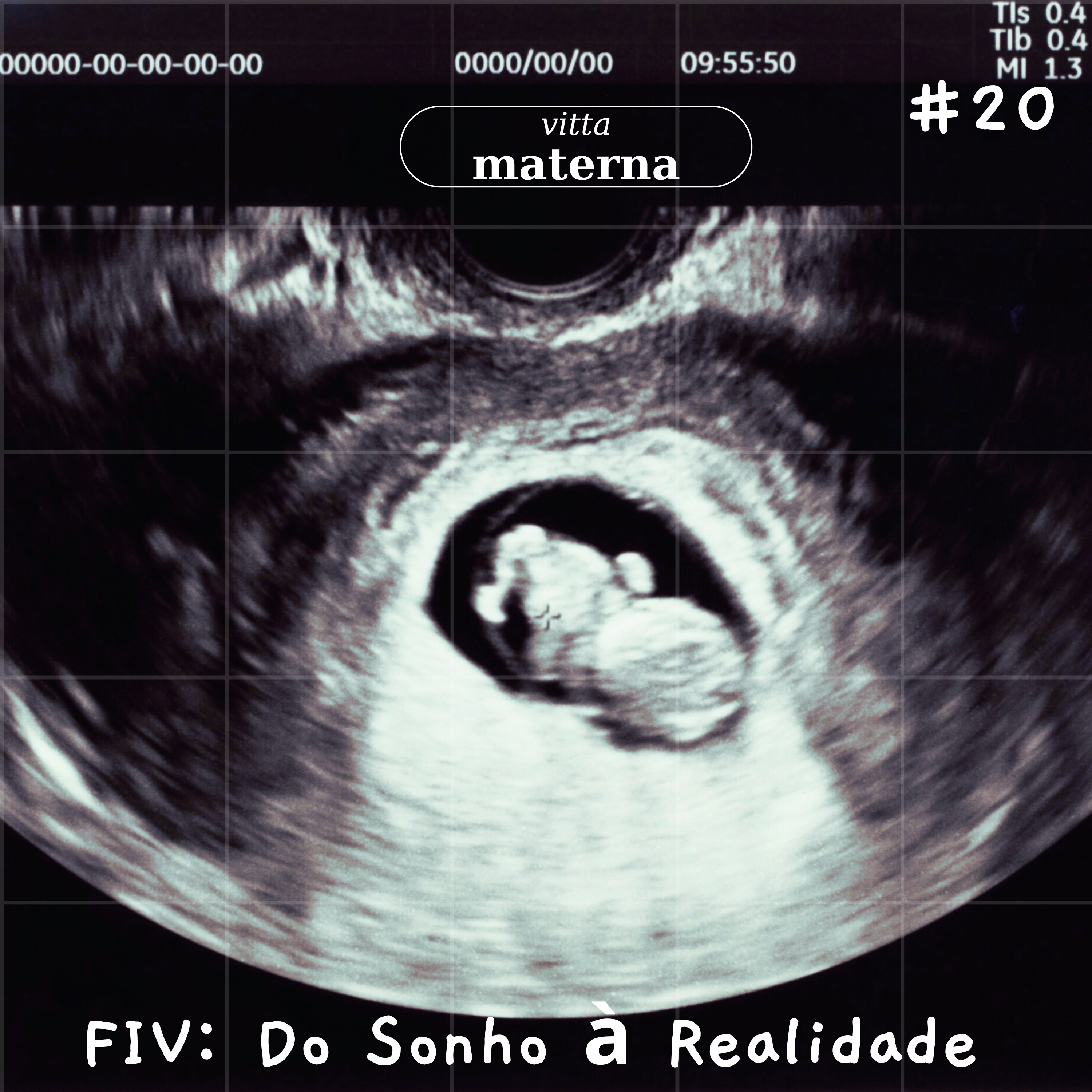 FIV: Do Sonho à Realidade – Relato de 5 anos de tentativa + Especialista explica passo-a-passo #20 episode artwork