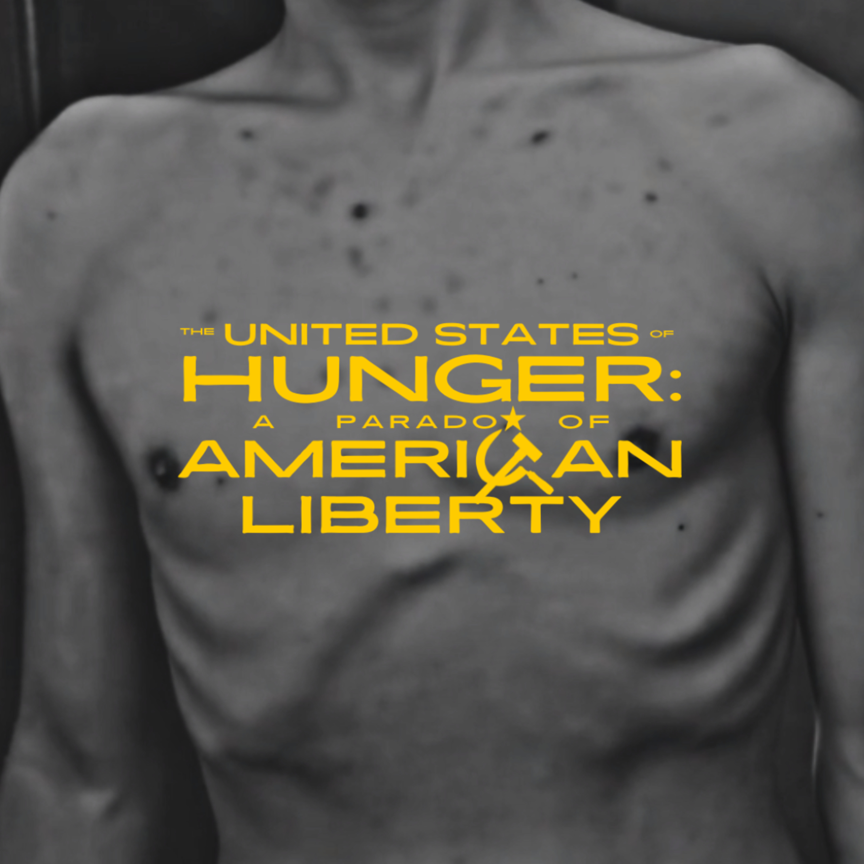 The United States of Hunger