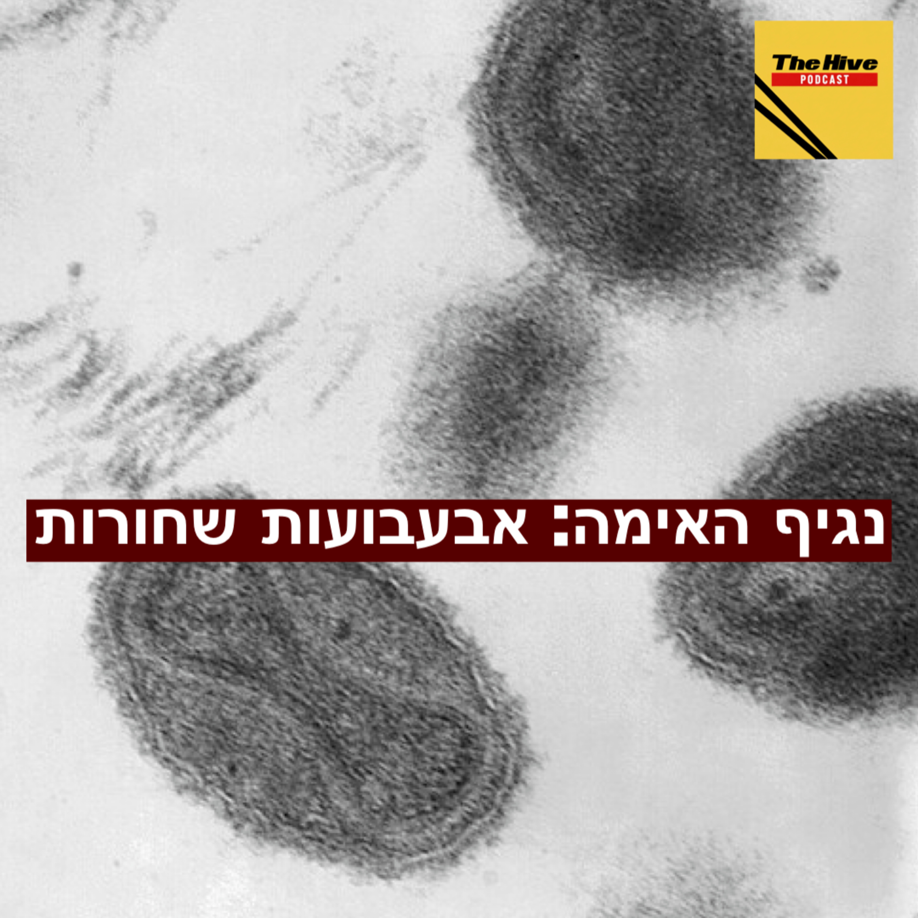 נגיף האימה: אבעבועות שחורות episode artwork