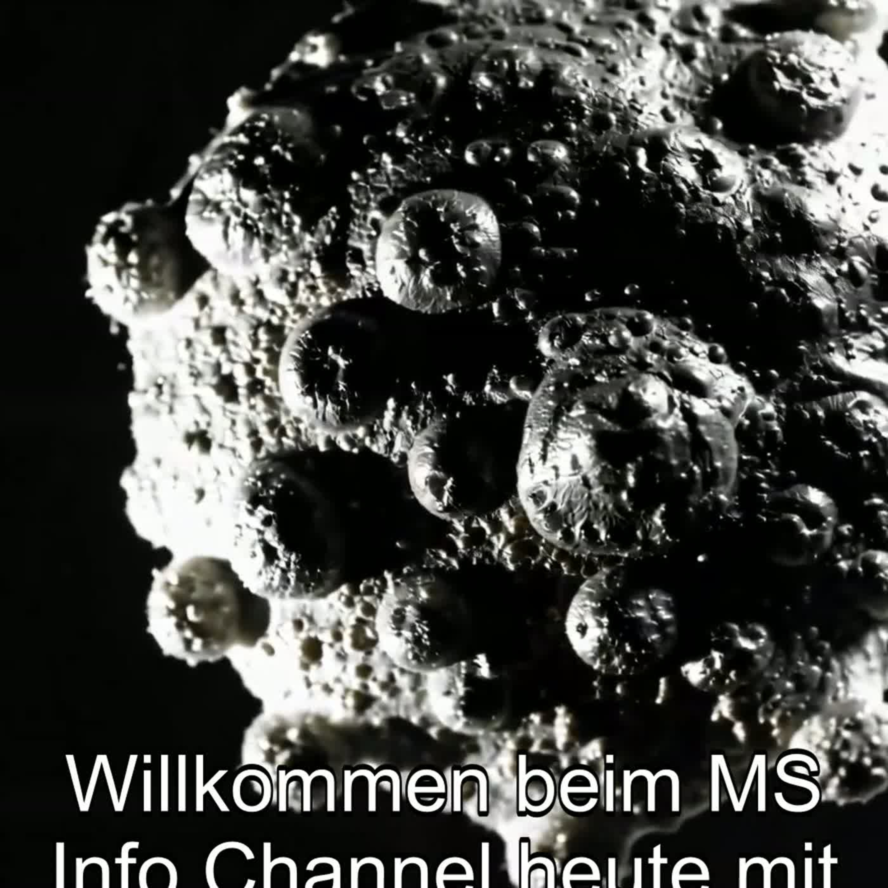 Teil 1/10 - Das Epstein-Barr-Virus: Was es ist, Übertragung & Latenz - MS Info Channel Podcast episode artwork