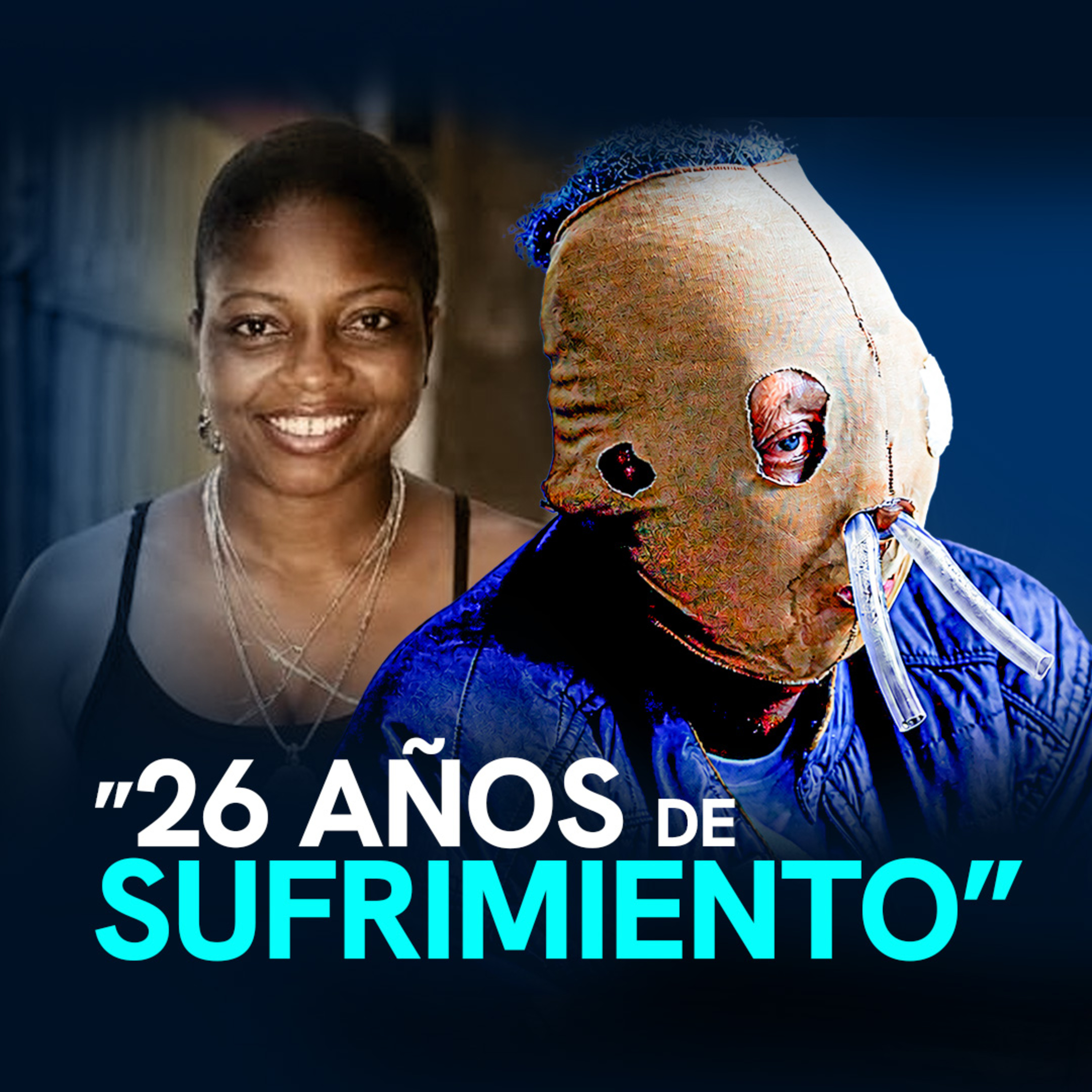 "ACCEDERÉ a la EUTANASIA, han sido 26 años de SUFRIMIENTO" #vamospaeso