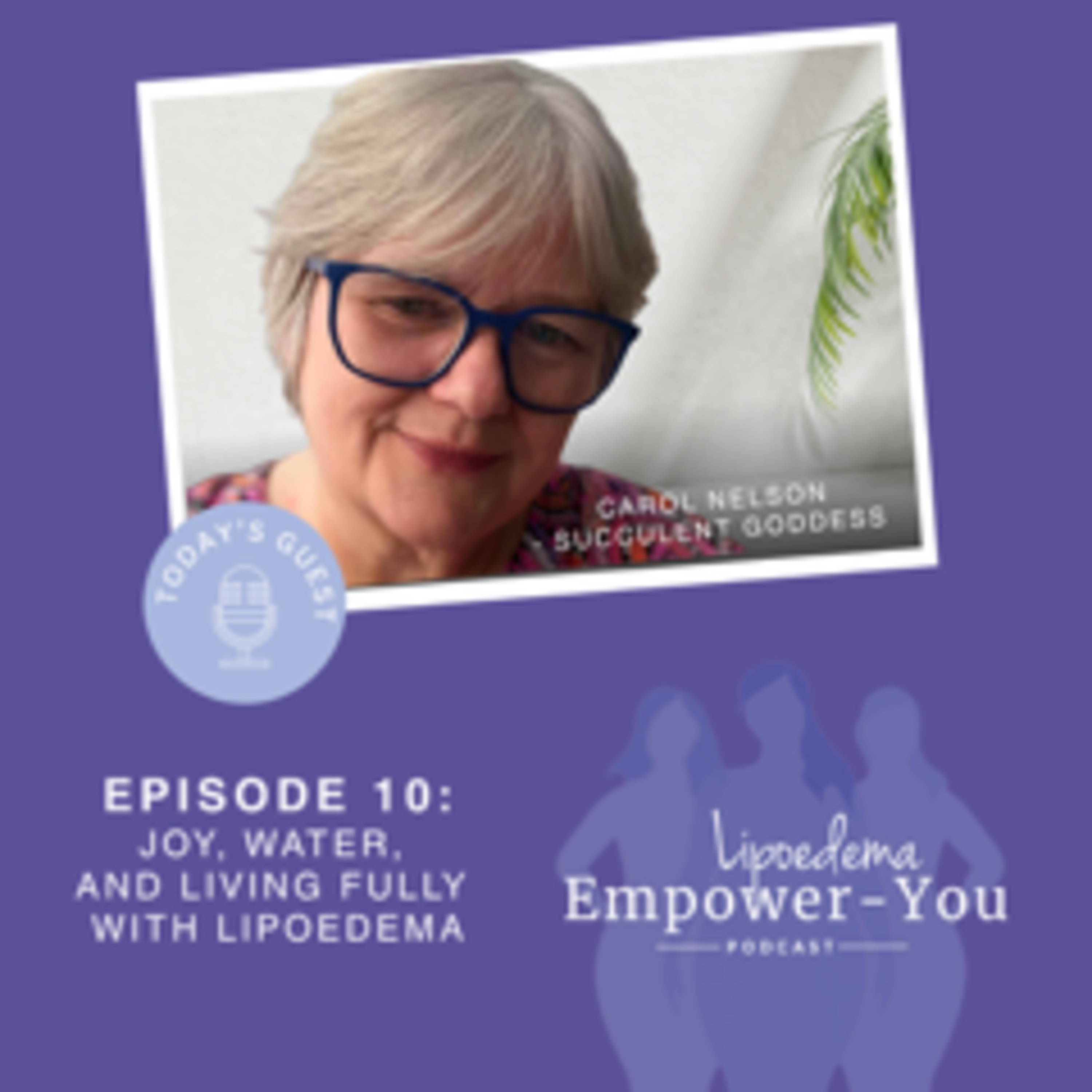 Carol’s Story: Choosing Joy in an Advanced Lipoedema Journey