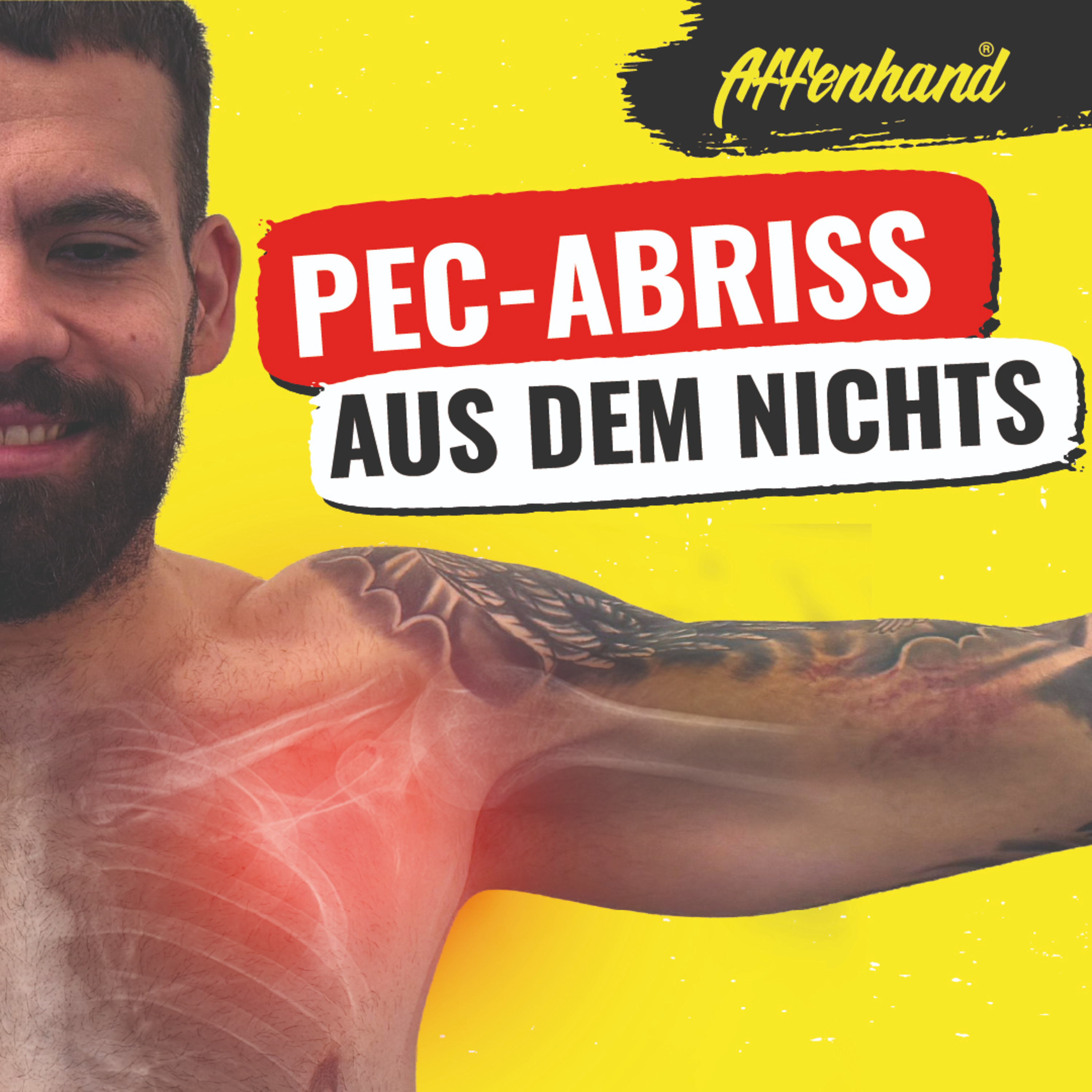 Pec-Abriss Reha: Zurück ins Training nach schwerer Sportverletzung | Max Keller & Matthias Lau episode artwork