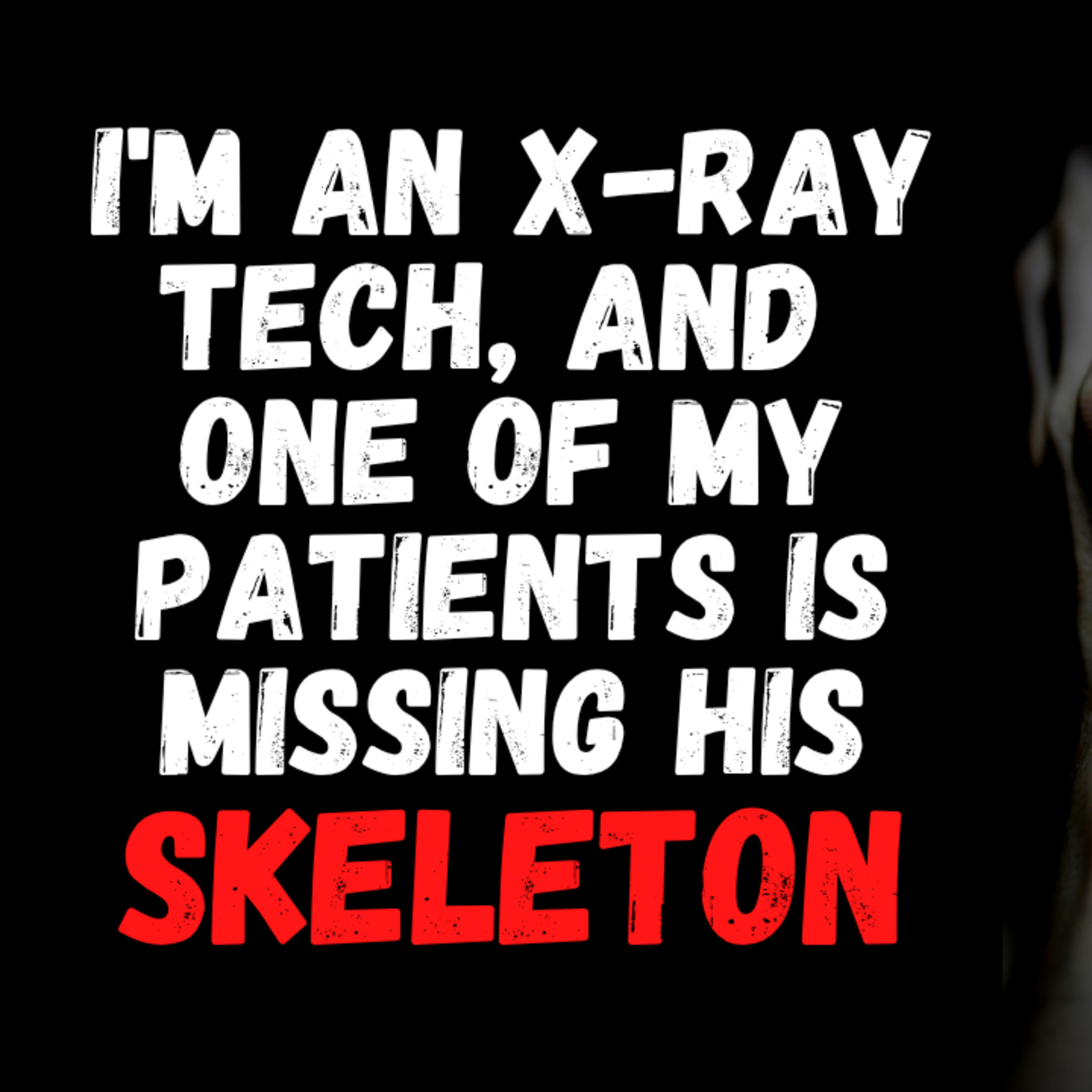I'm an X-ray tech, and one of my patients is missing his skeleton episode artwork