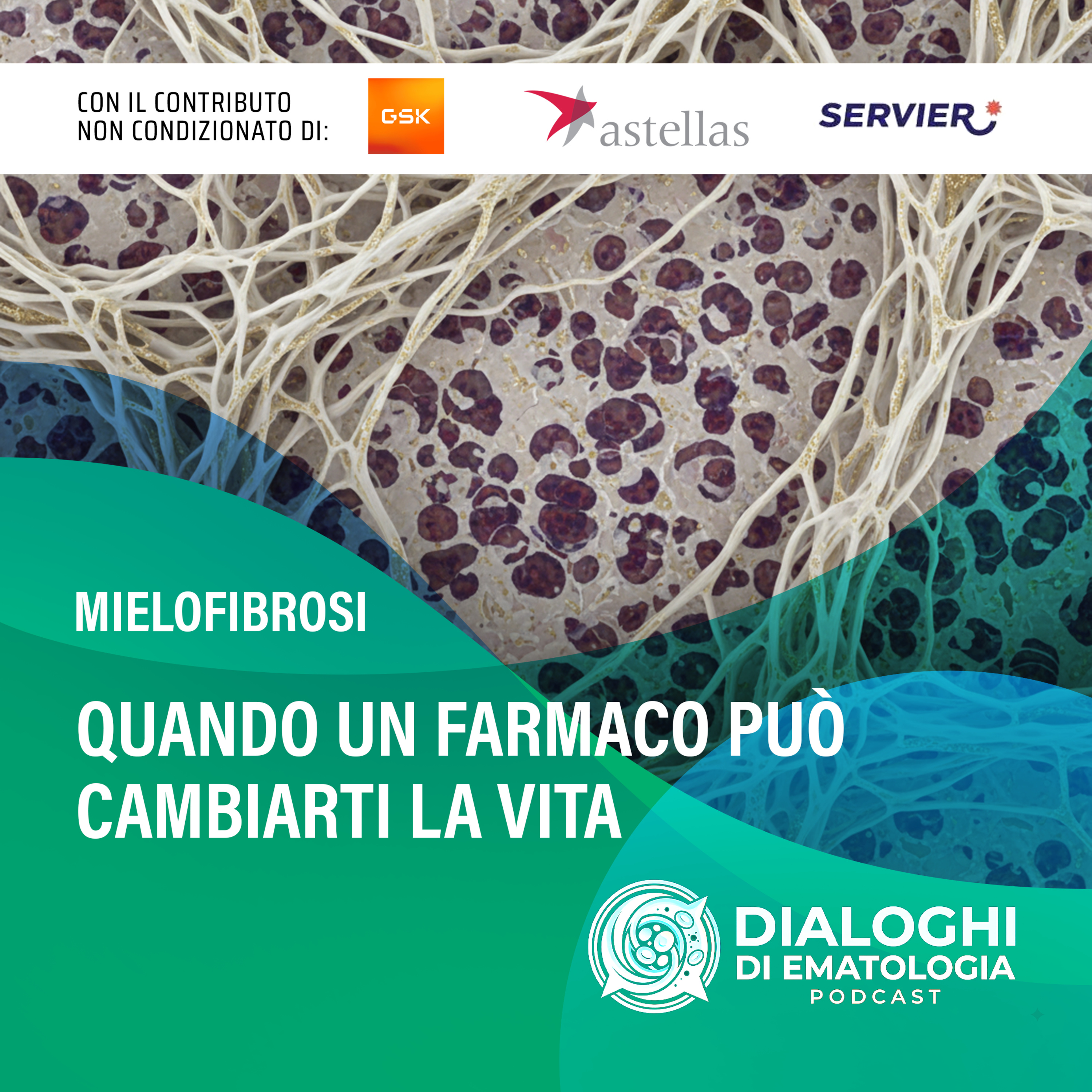 Mielofibrosi — Quando un farmaco può cambiarti la vita episode artwork