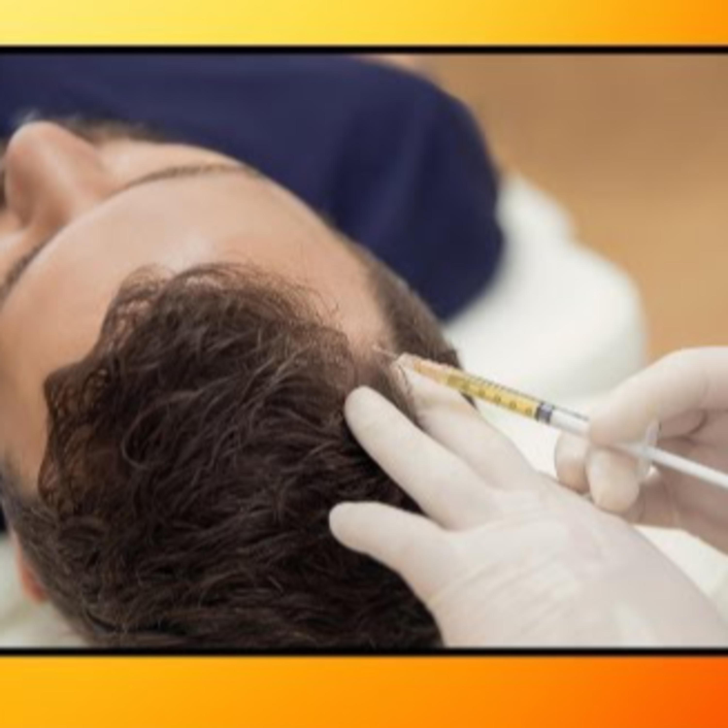 Hair Transplant Podcast - HAIR TALK with Dr.John Watts Hair Transplant Surgeon and Dermatologist