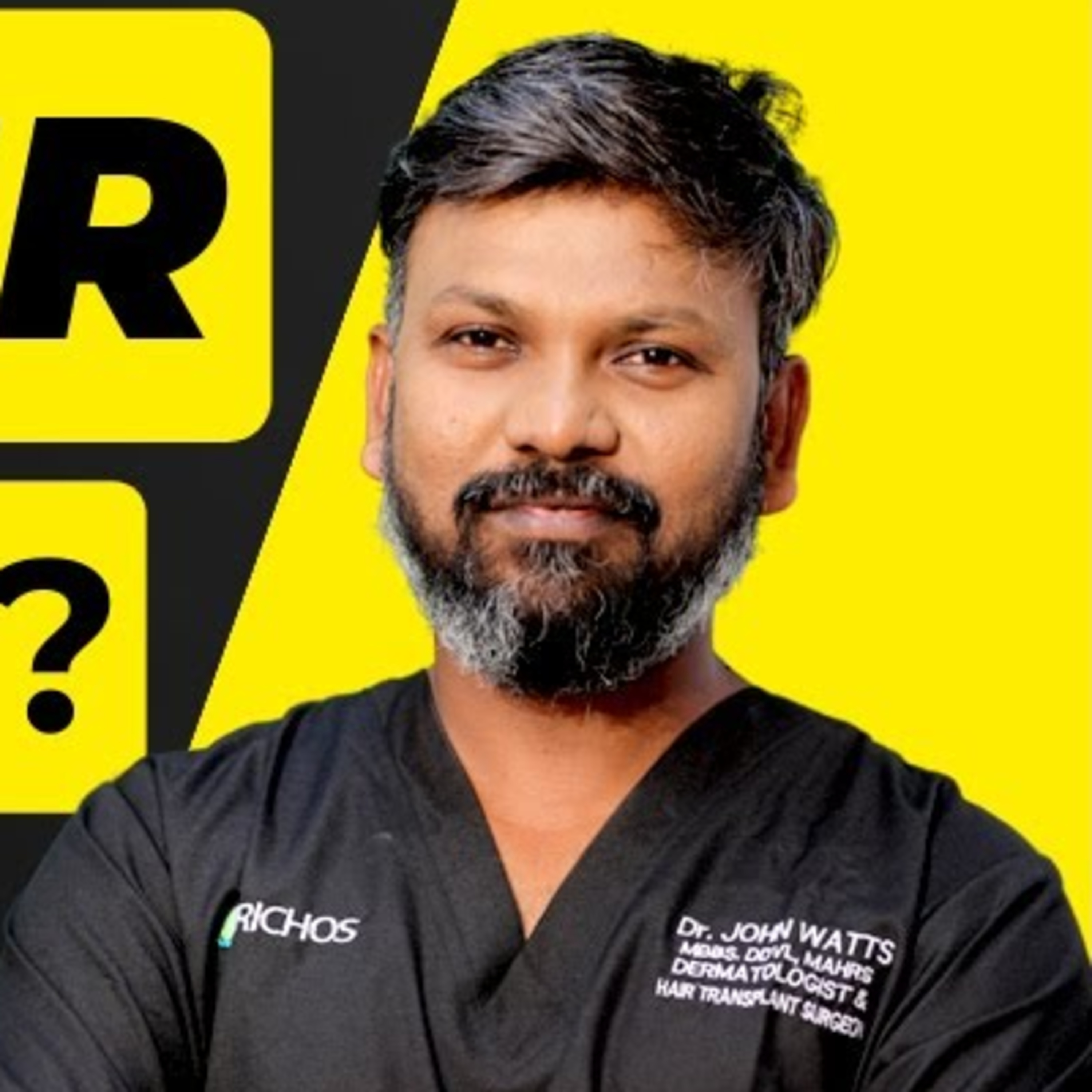 Can a hair transplant procedure be termed successful if one loses existing hair?
