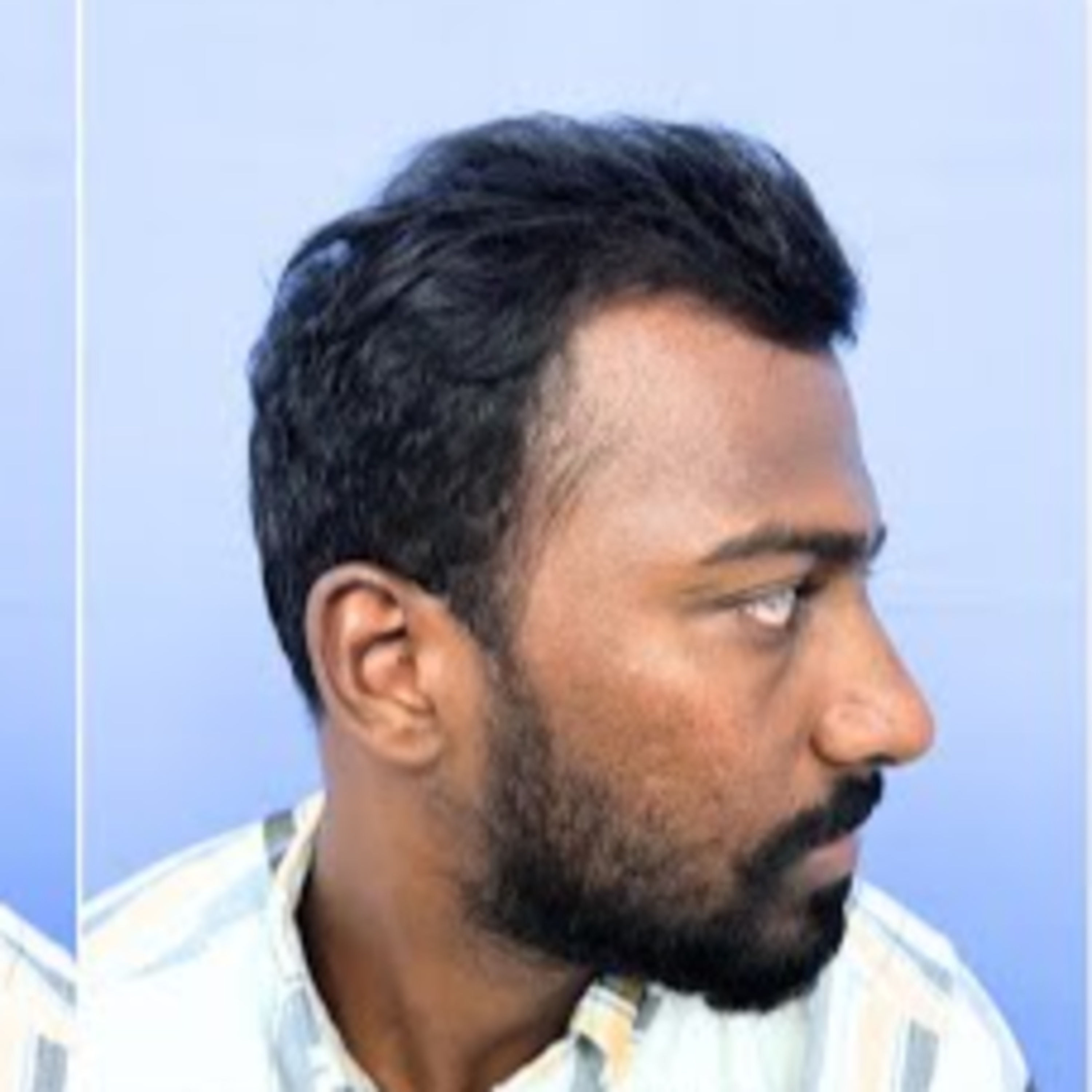Doesn’t Ashok’s hairline appear to be receding? What parameters were used to design Ashok’s hairline the way it is now?
