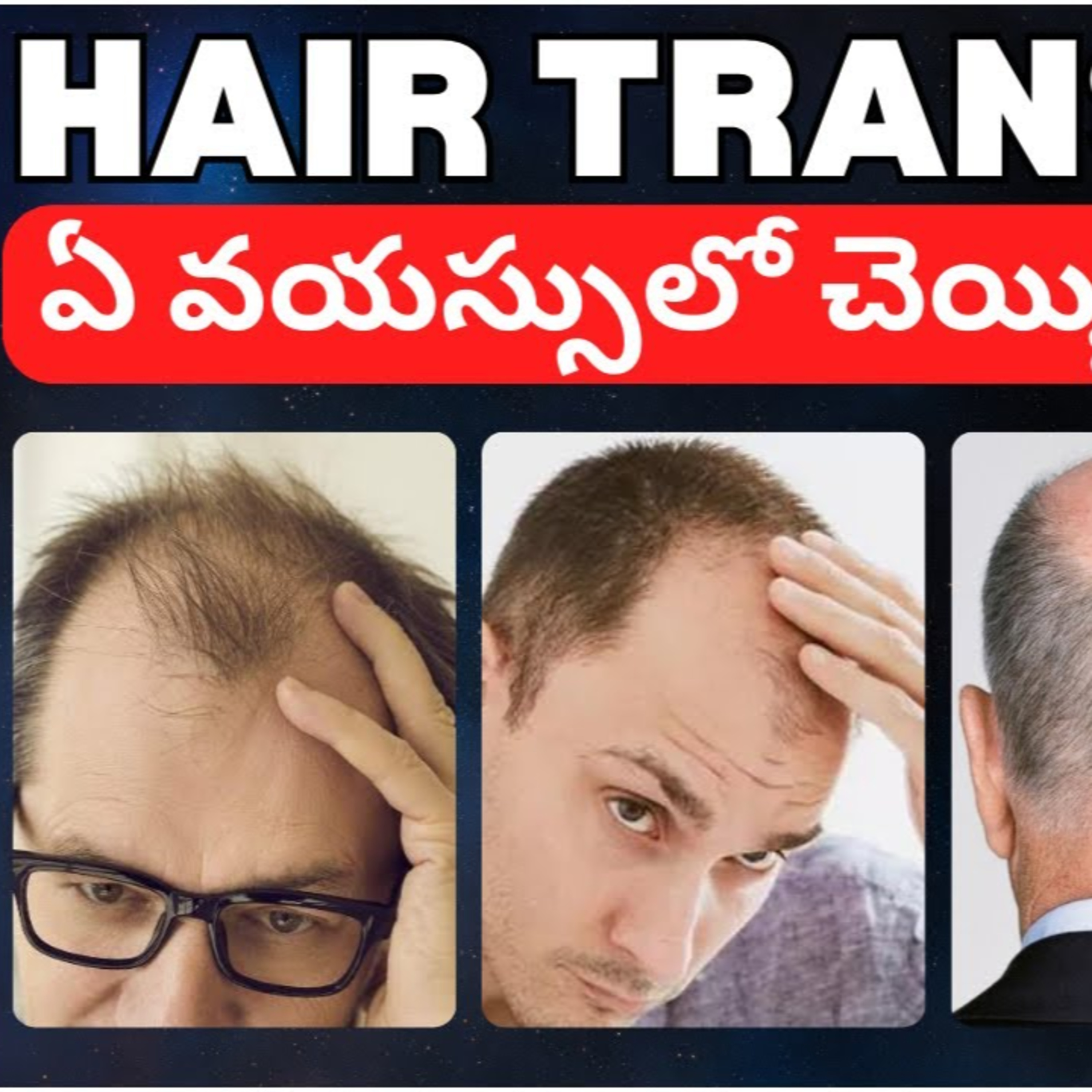What is the best age to undergo a hair transplant procedure?