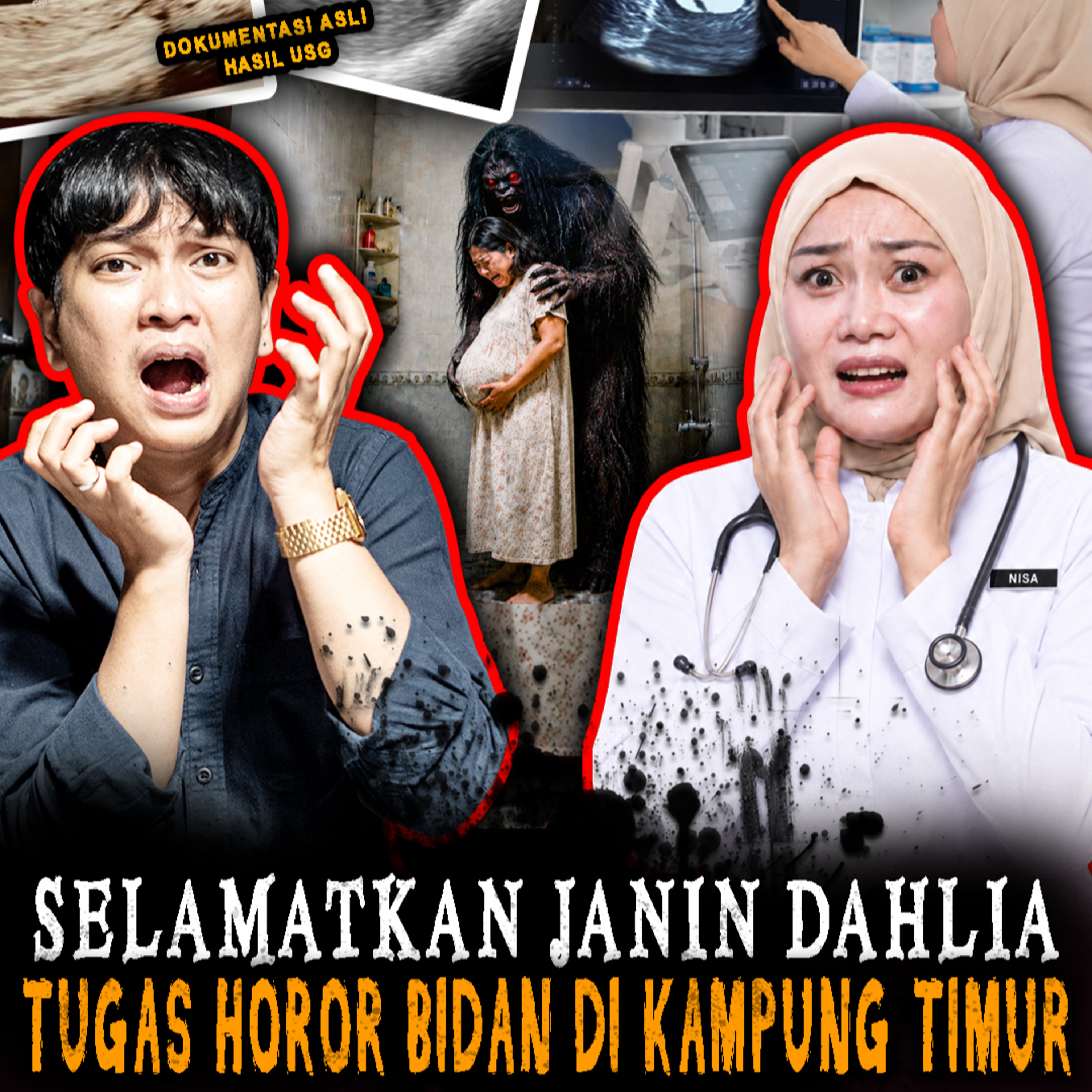 844 JANIN PASIENKU MENDADAK HILANG !! SETELAH 6 TAHUN PENANTIAN