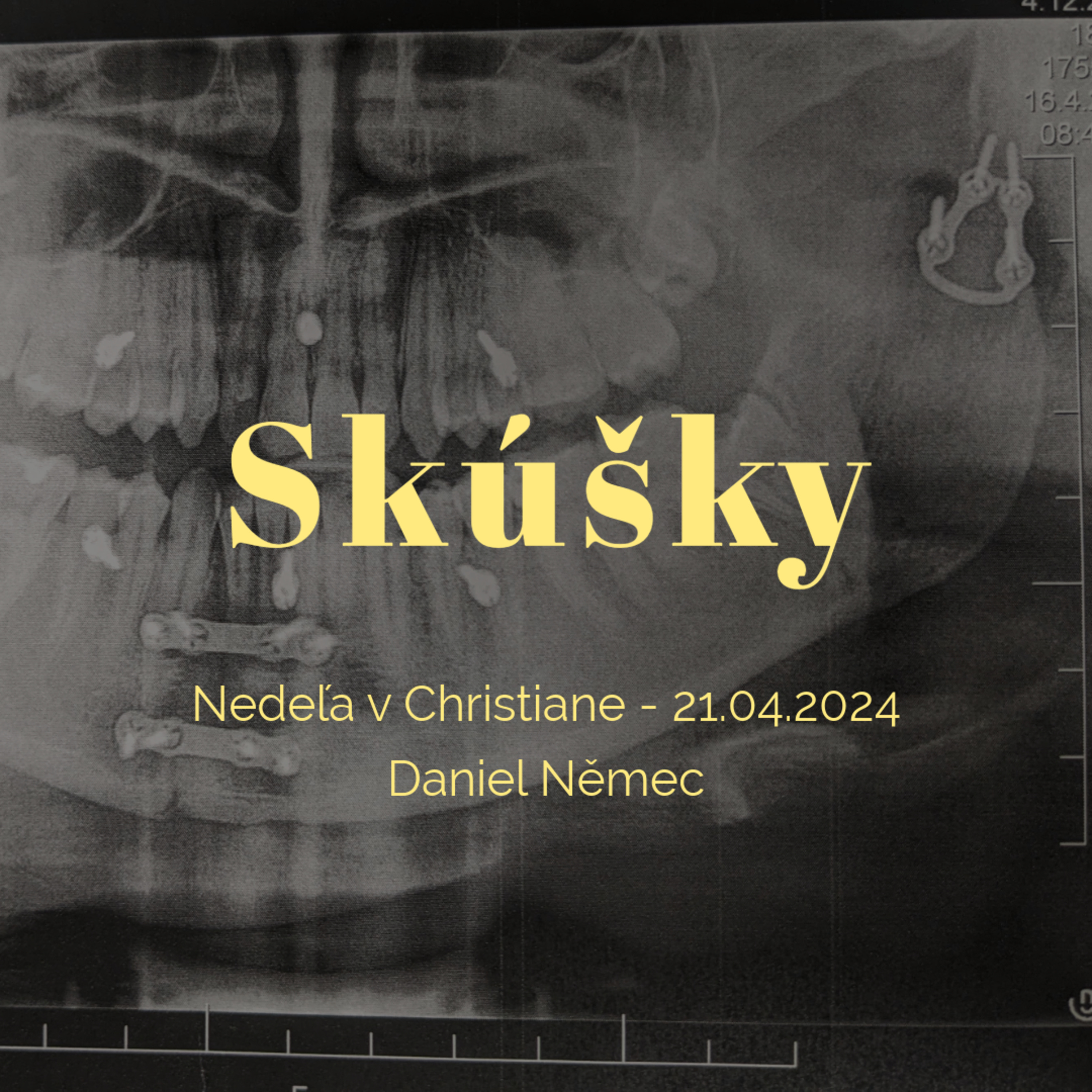 Skúšky - Daniel Němec episode artwork