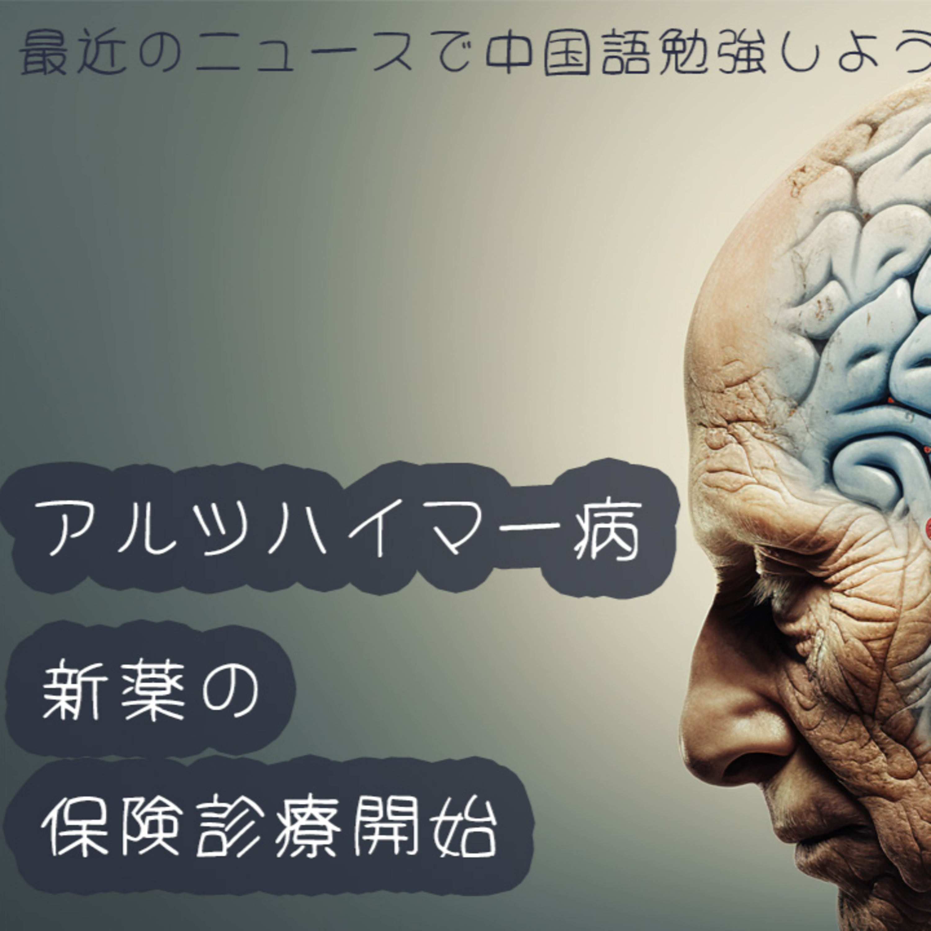 アルツハイマー病の新薬保険診療開始 中国語 リスニング 聴解 ニュース