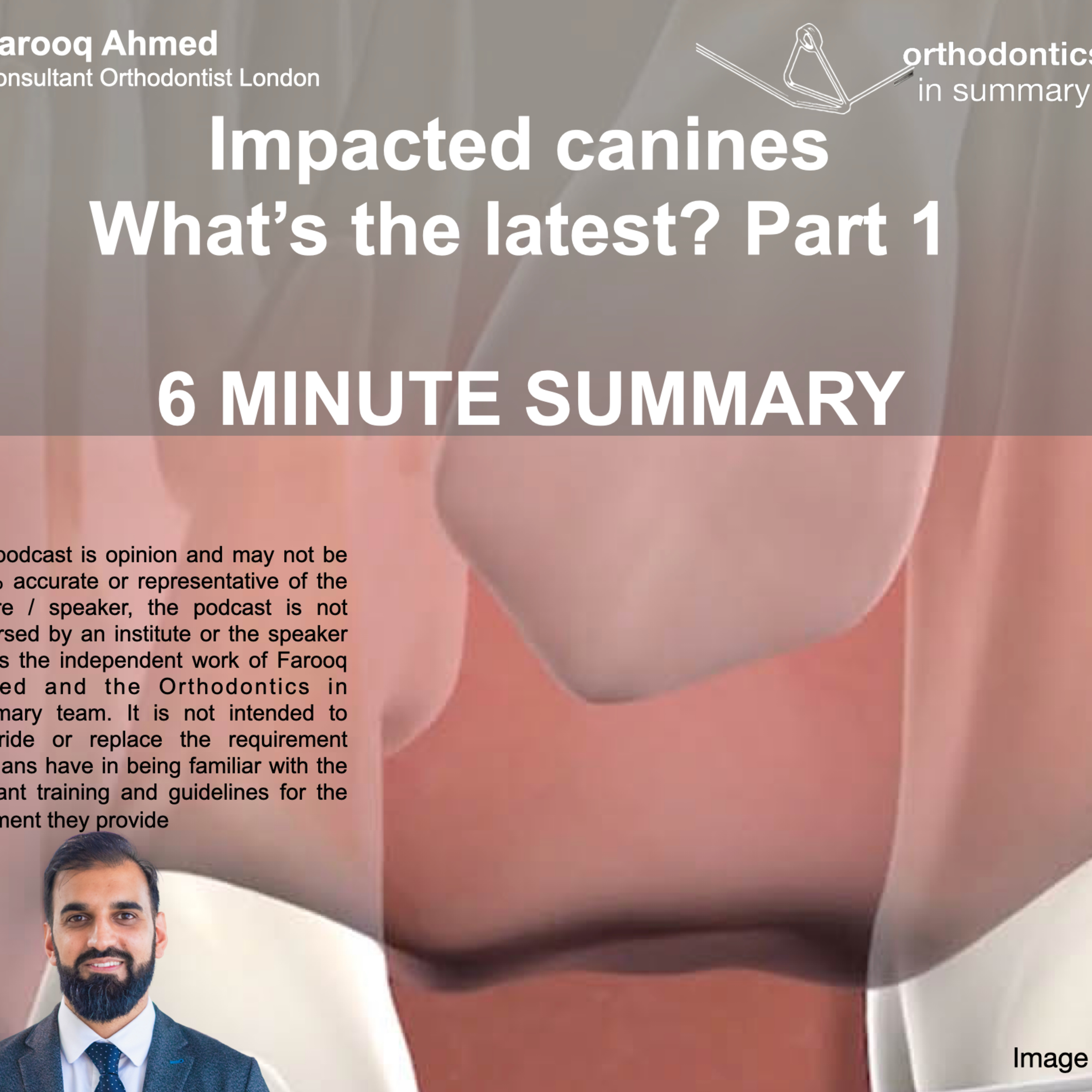 Impacted canines, what’s the latest? Part 1 | 6 MINUTE SUMMARY