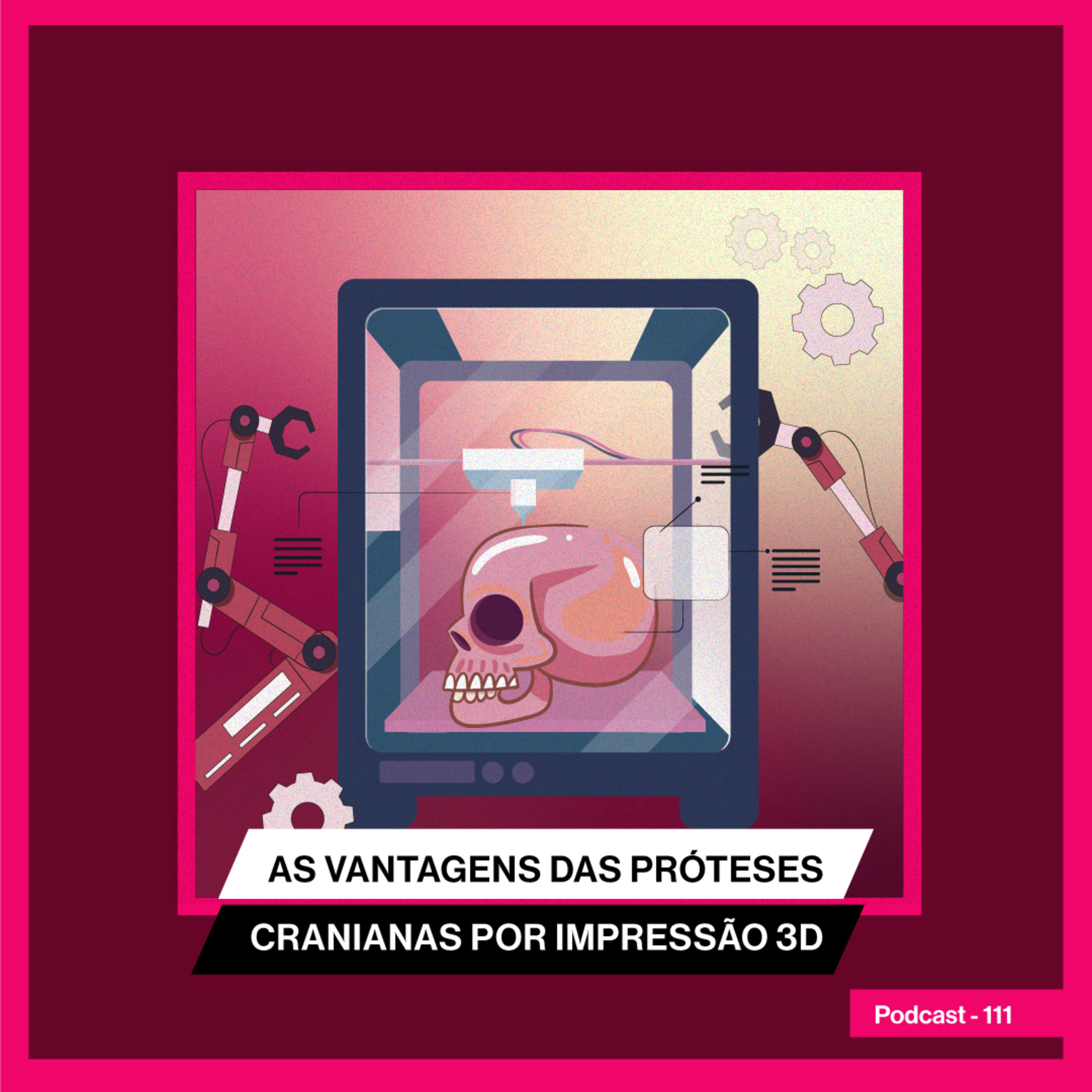 As vantagens das próteses cranianas por impressão 3D